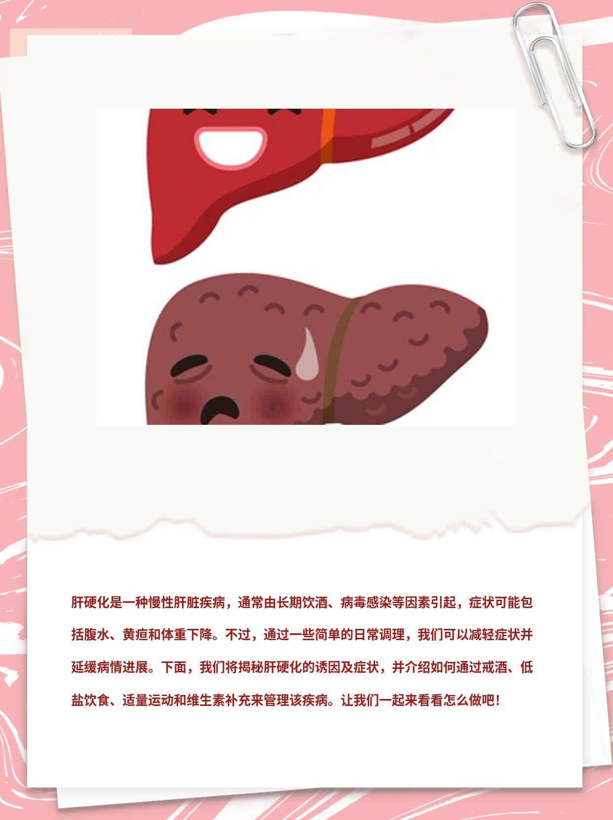 「揭秘」肝硬化诱因及症状解析
