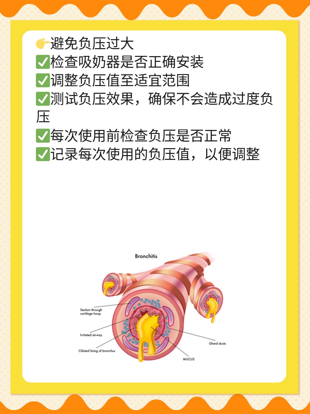「宝妈必看」吸奶器导致乳头肿胀的原因及处理方法