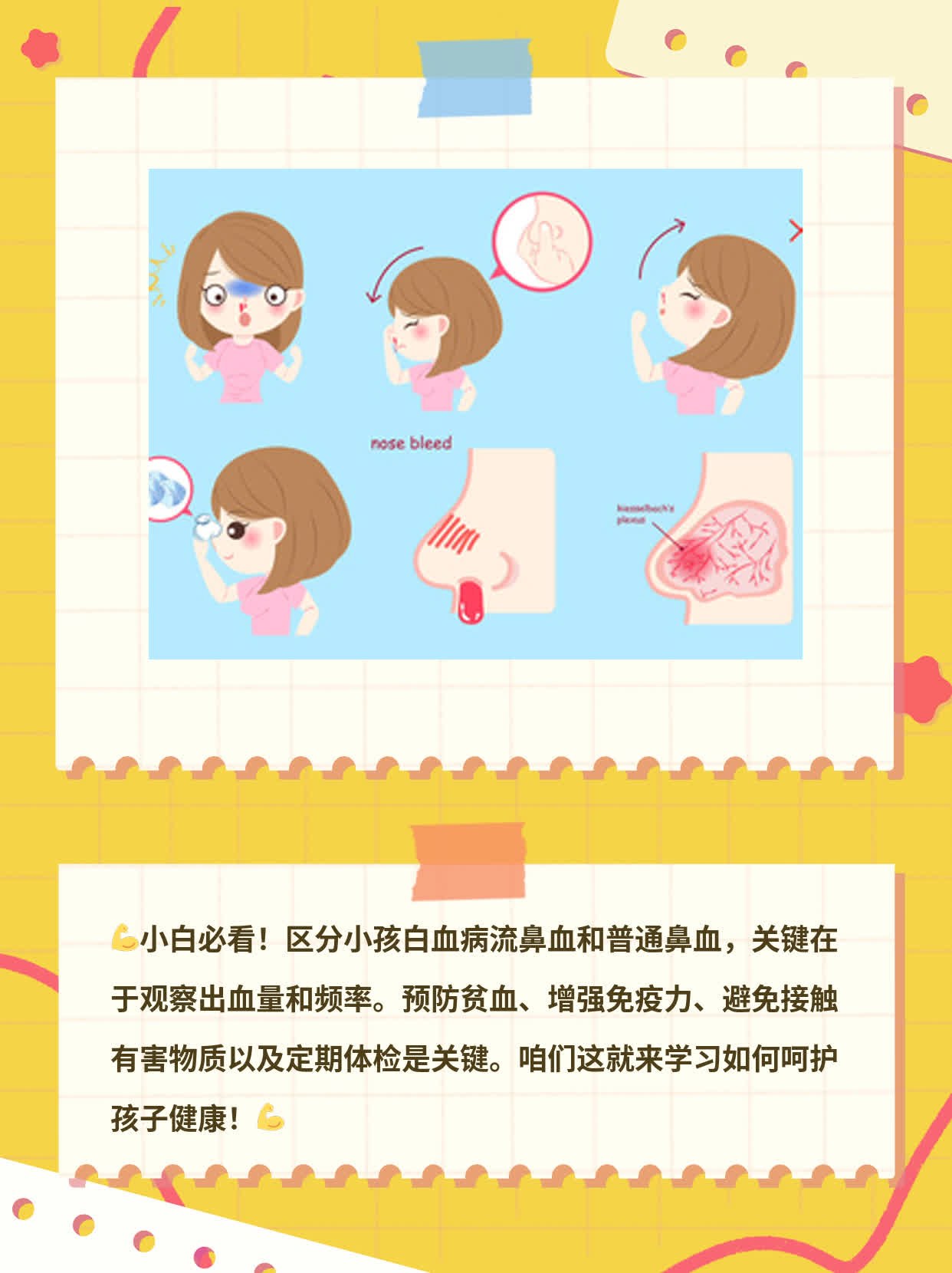 「小白必看」小孩白血病流鼻血 vs 普通鼻血，你分得清吗？