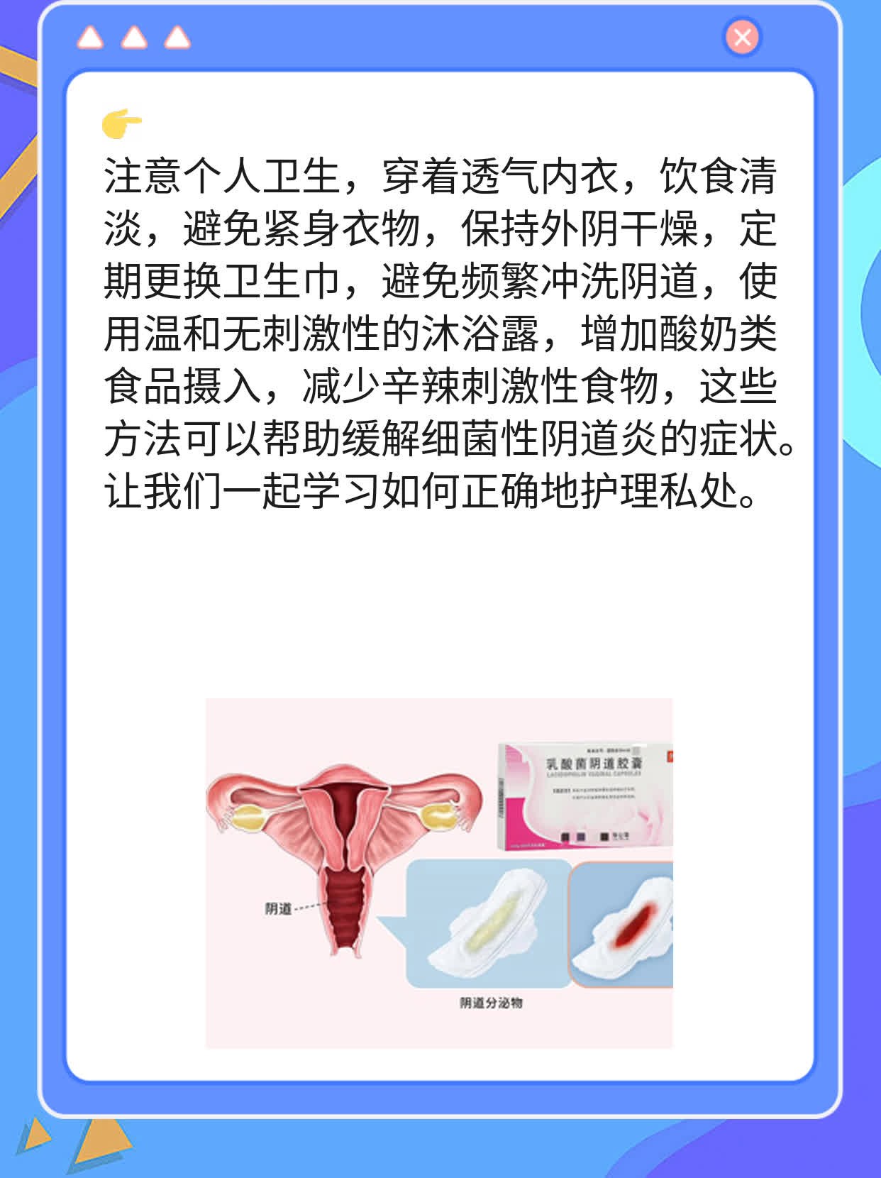 「经验分享」细菌性阴道炎用药攻略