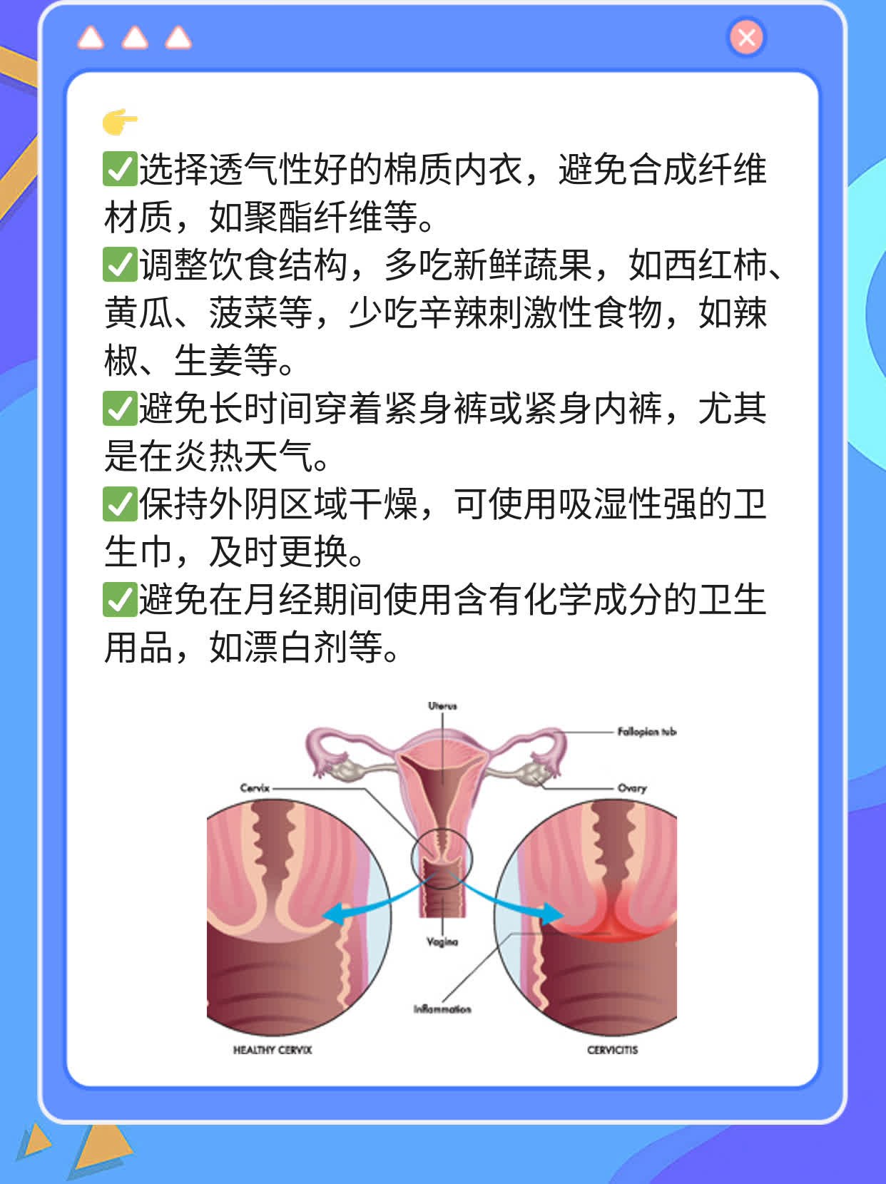 「经验分享」细菌性阴道炎用药攻略