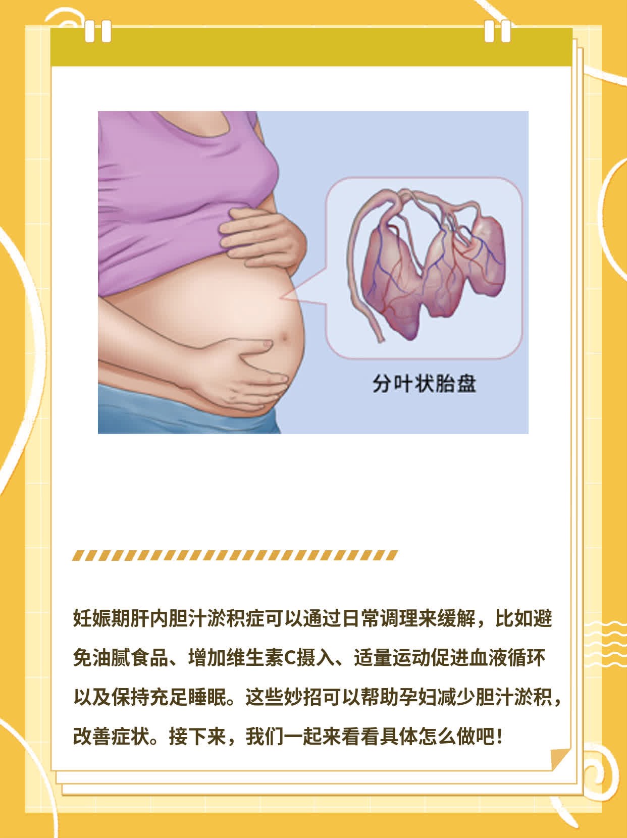 「孕期黄疸」：胆汁淤积症的妙招解围！