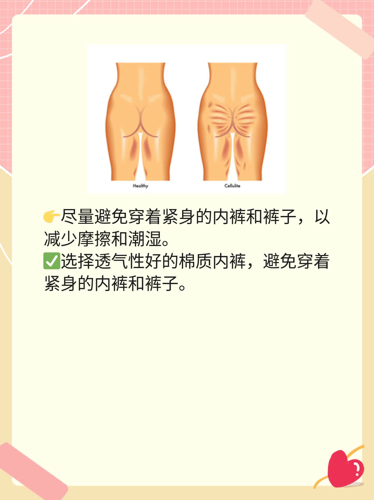 「有图有真相」霉菌性阴道炎传男症兆