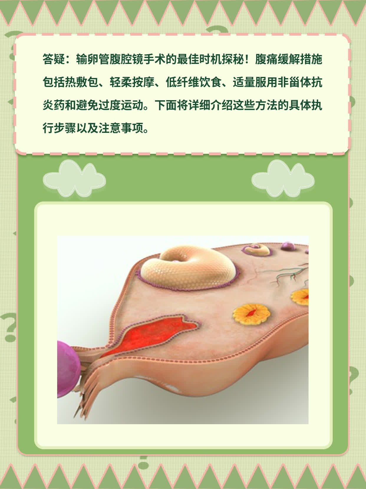 「答疑」输卵管腹腔镜手术最佳时机探秘
