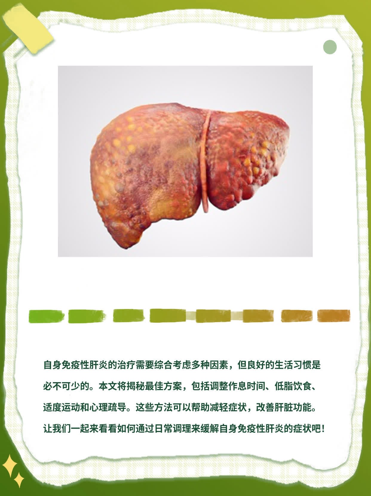 「自身免疫性肝炎」治疗攻略：揭秘最佳方案！