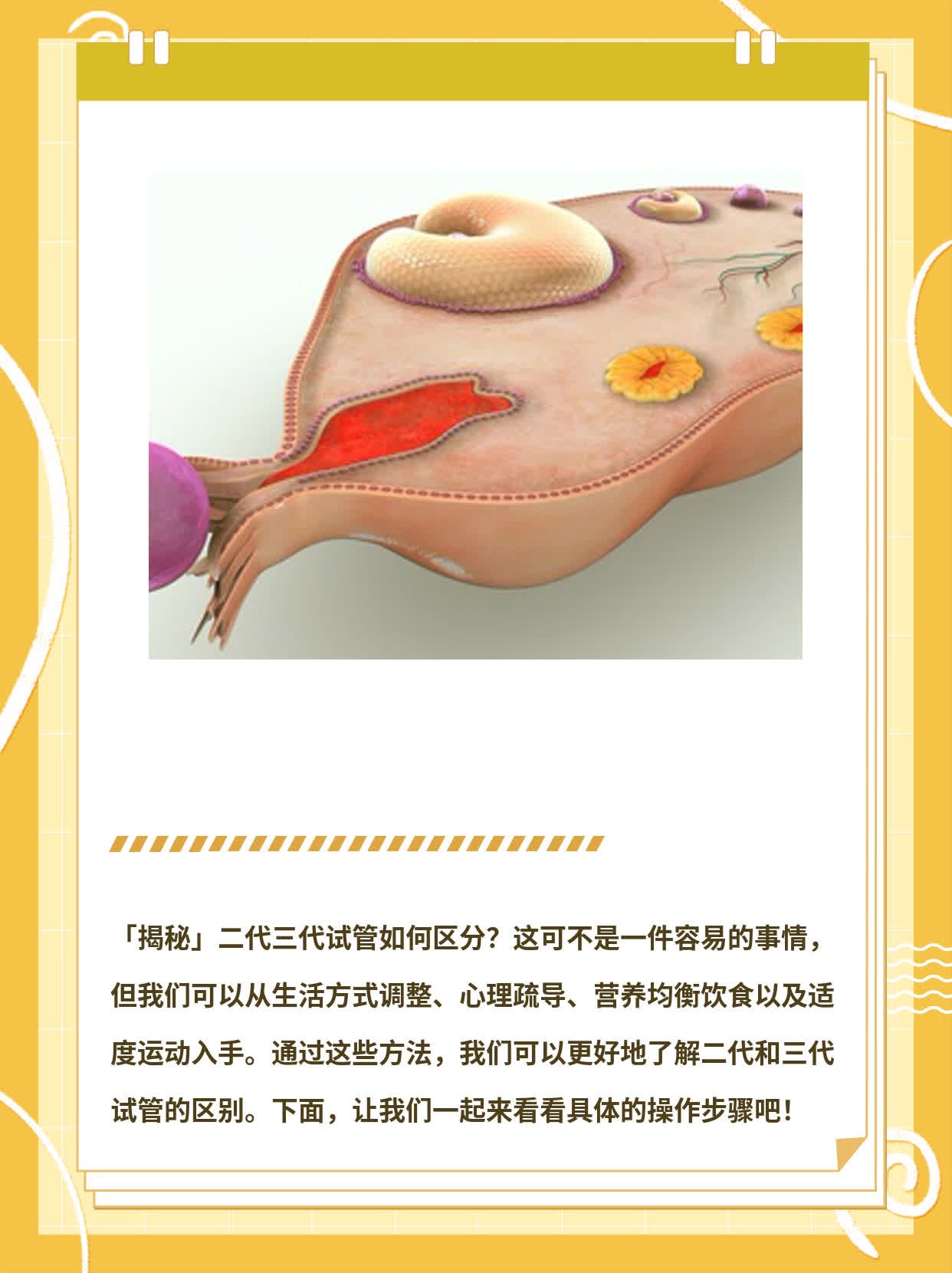 「揭秘」二代三代试管如何区分？