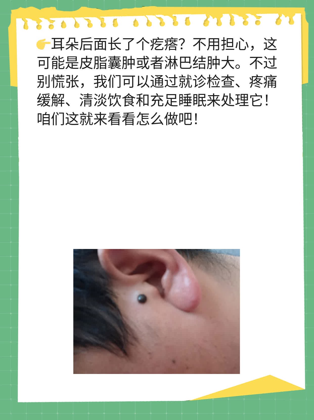 耳朵后面长了个疙瘩是怎么回事