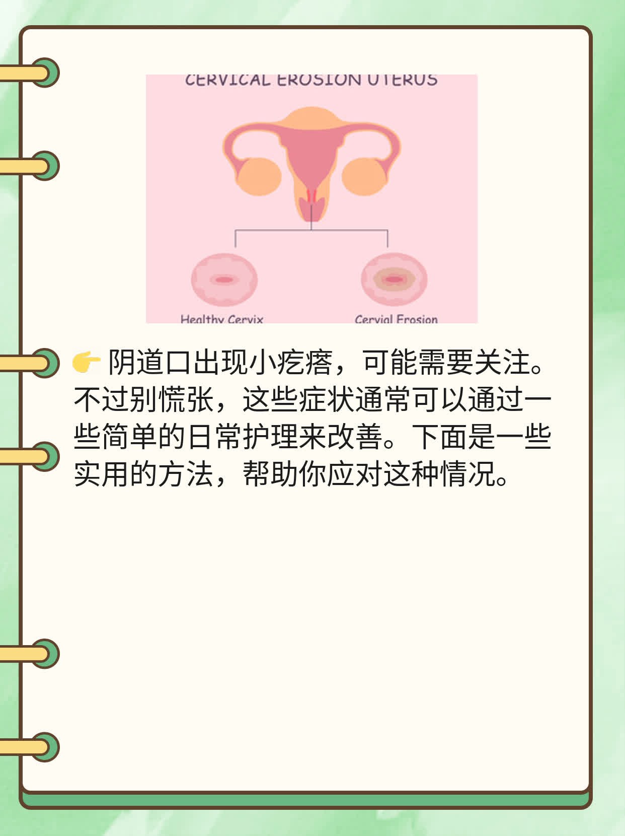 阴道 