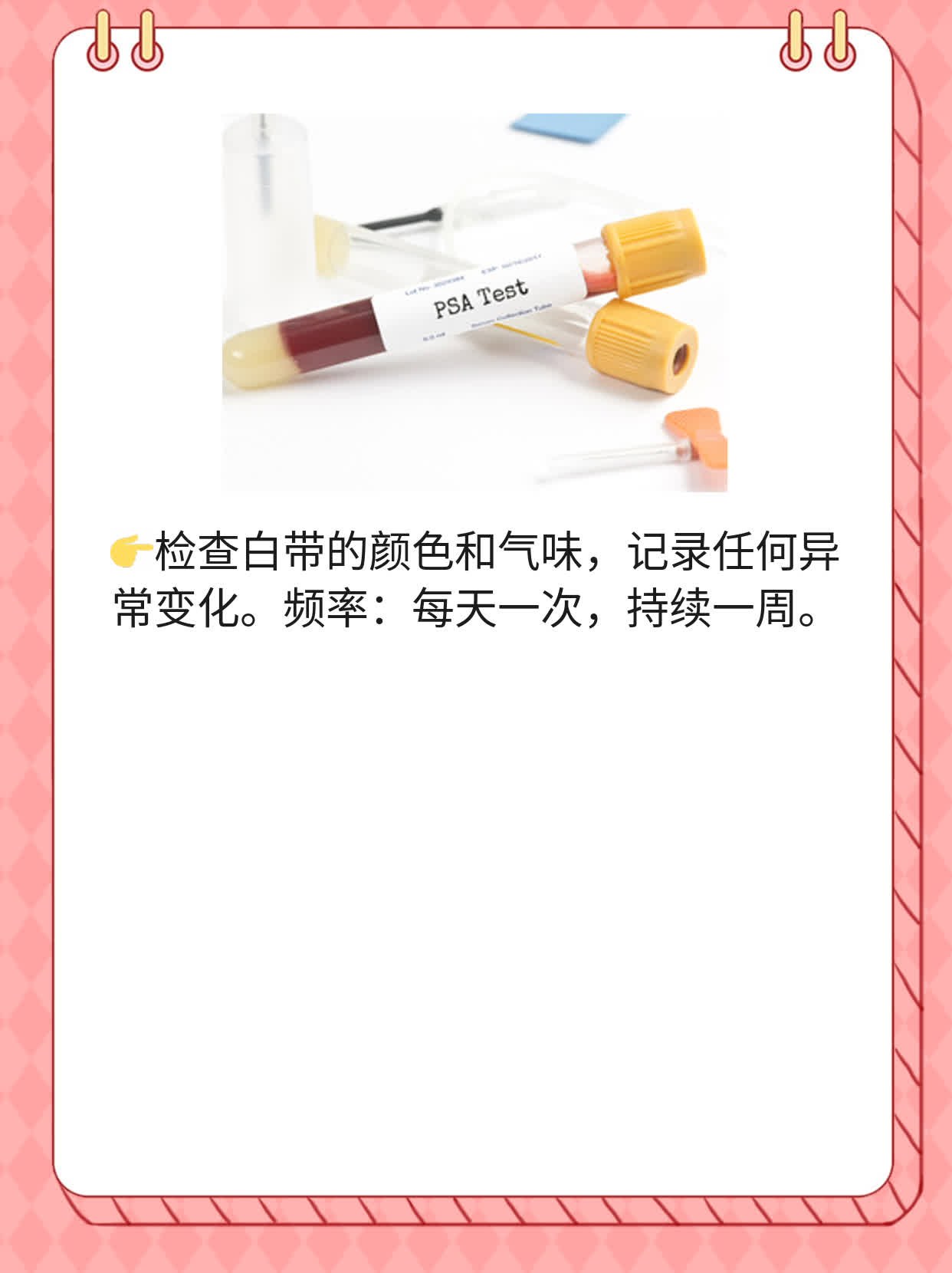 探秘阴道分泌物：白色液体的原因解析