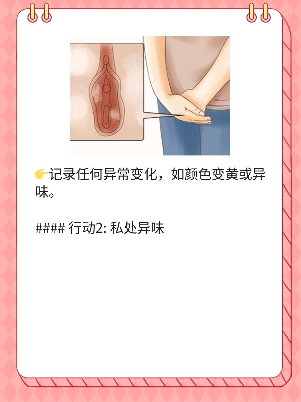 探秘阴道分泌物：白色液体的原因解析