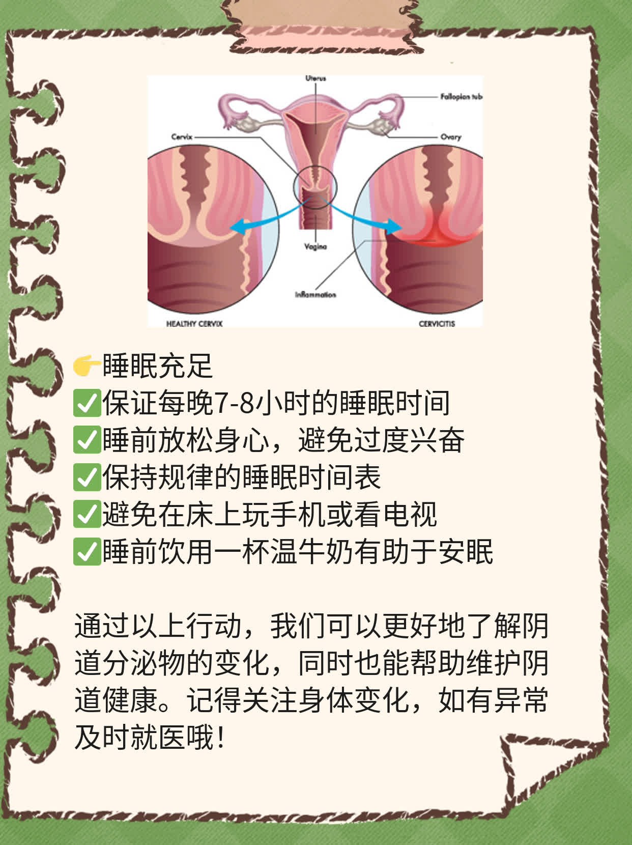 探秘阴道分泌物：白色糊状黏液的秘密