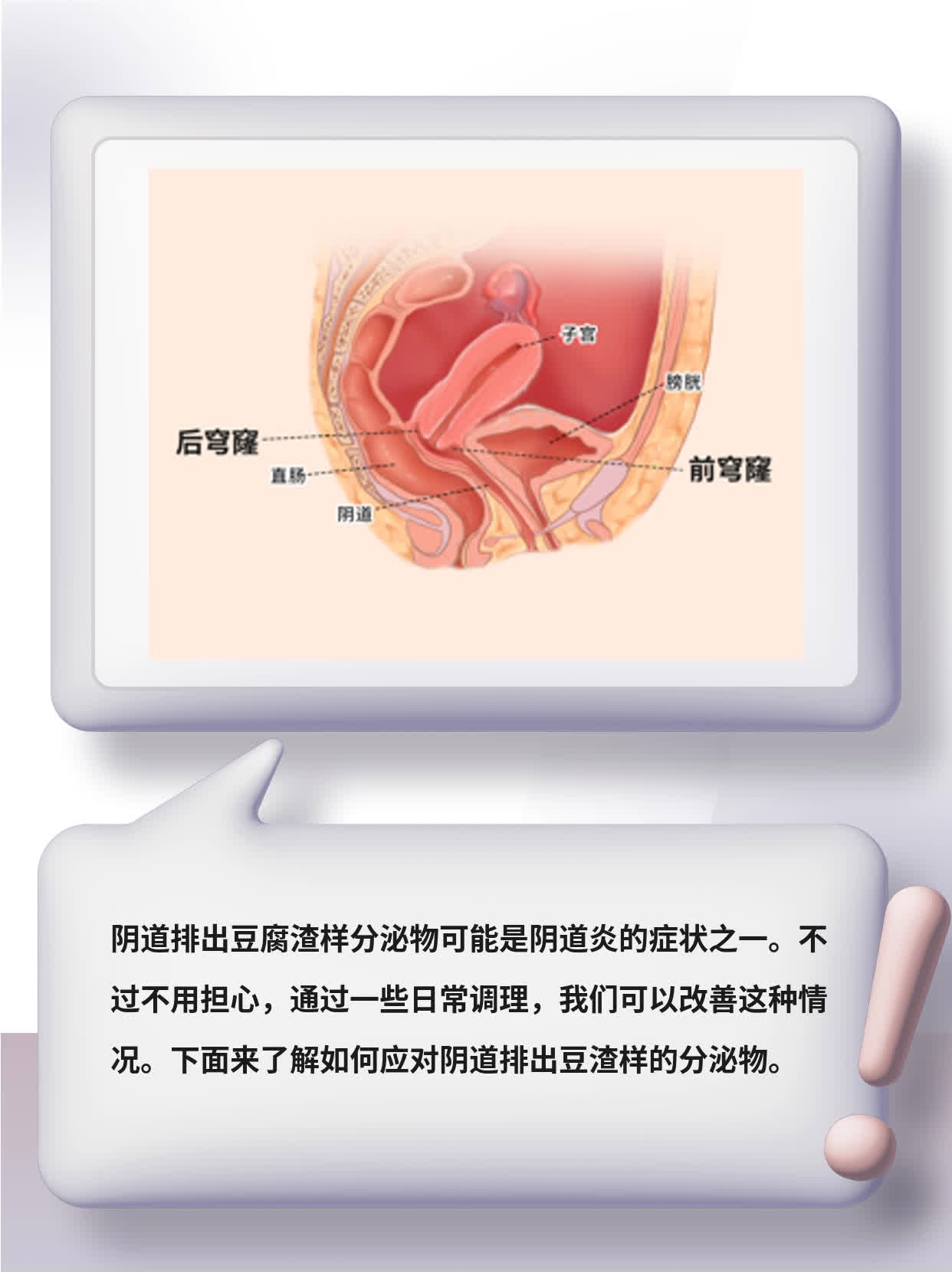 「有图有真相」阴道排“豆渣”？