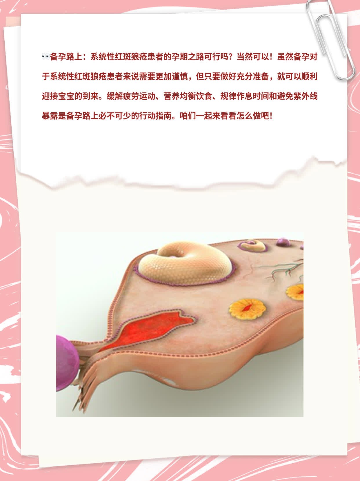 备孕路上：系统性红斑狼疮患者的孕期之路可行吗？
