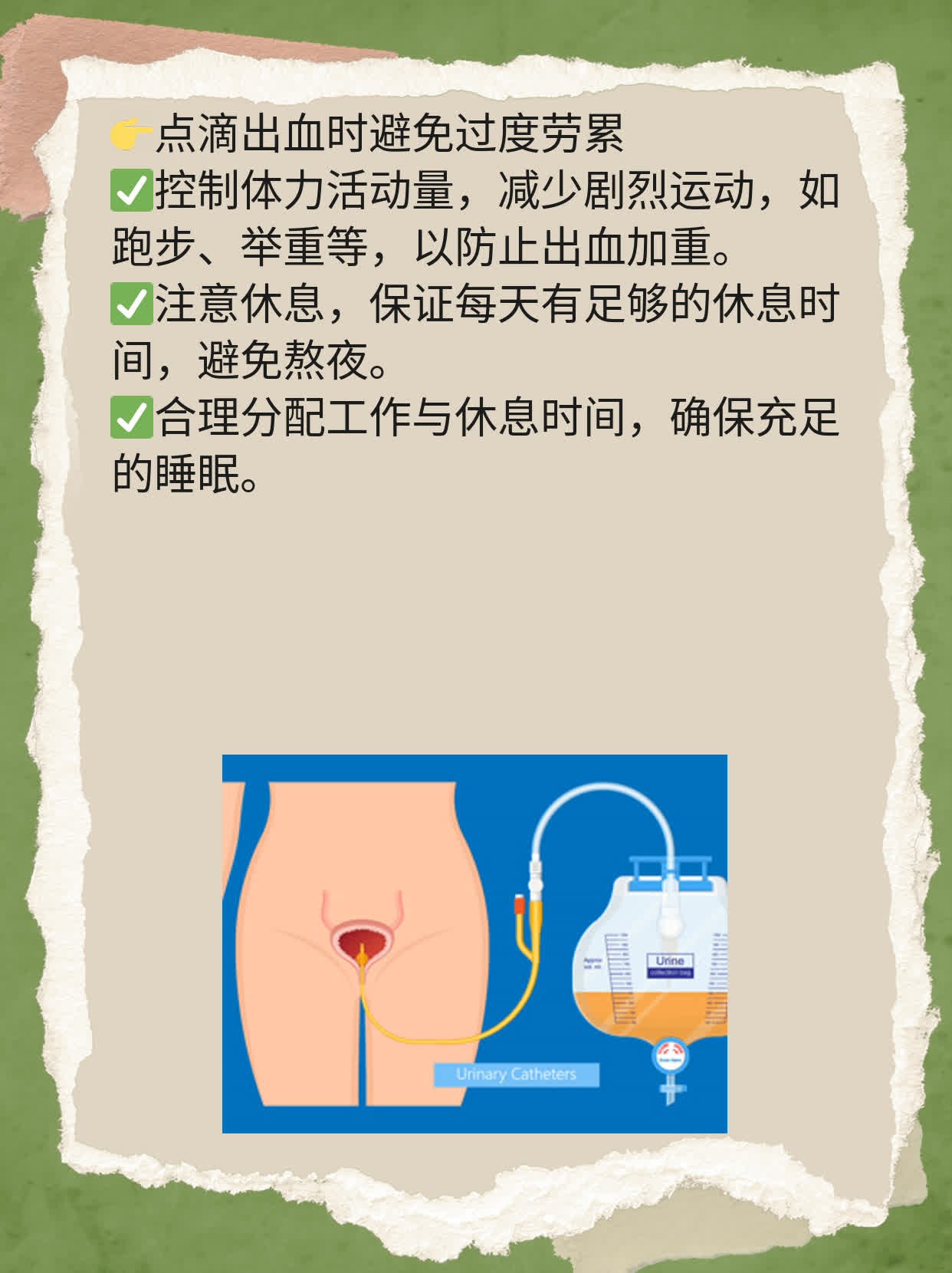 避孕药后出血？这可能是它的副作用！