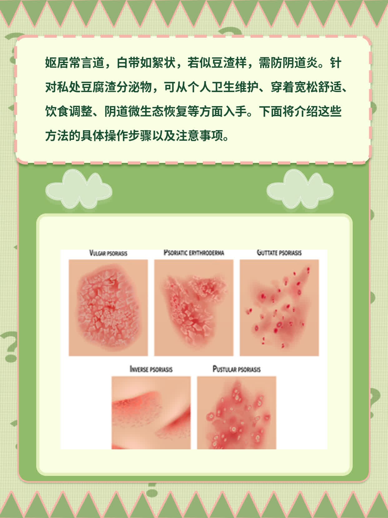 女人下面豆腐渣 年龄图片