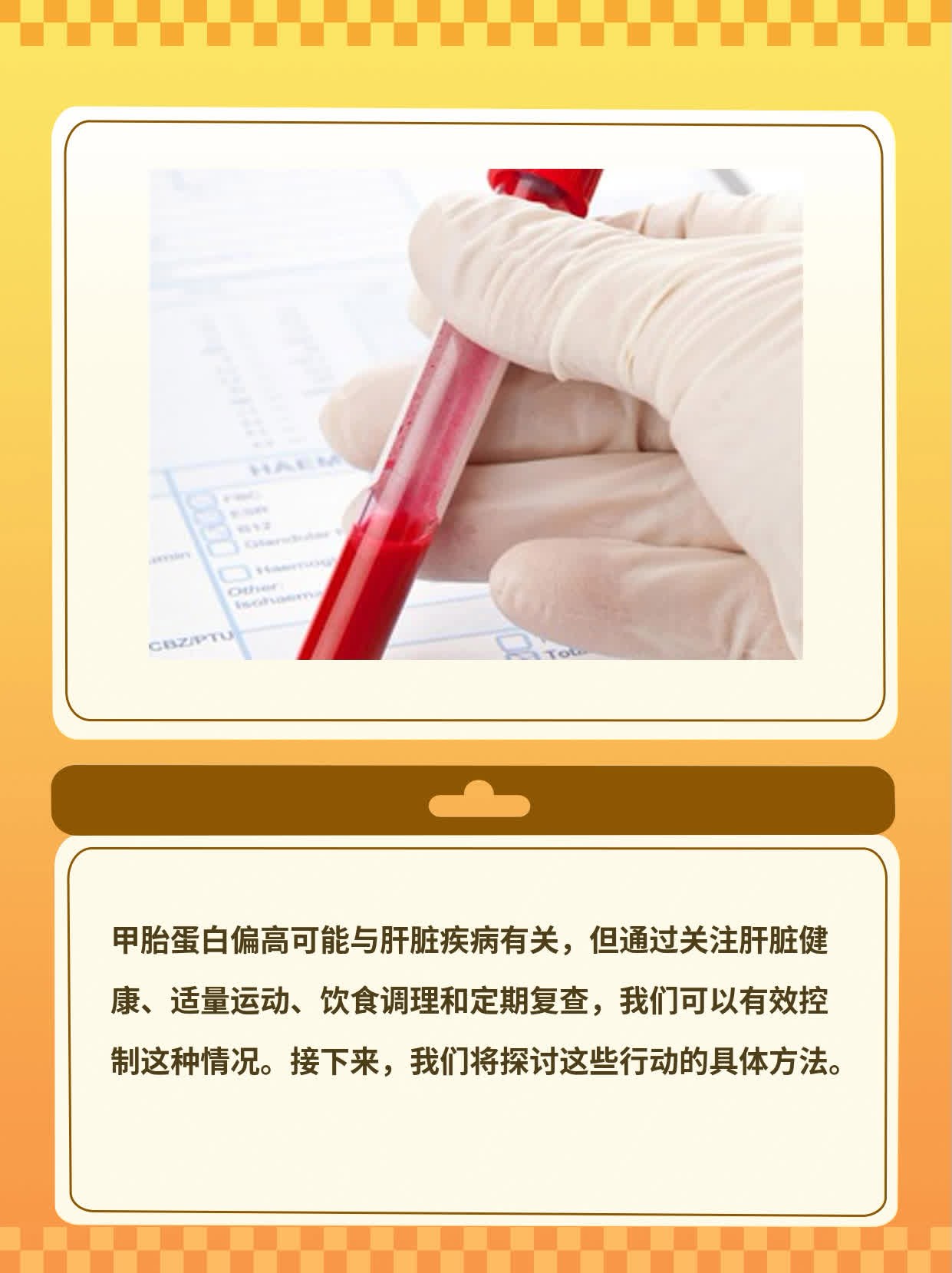 揭秘：甲胎蛋白偏高背后的原因！