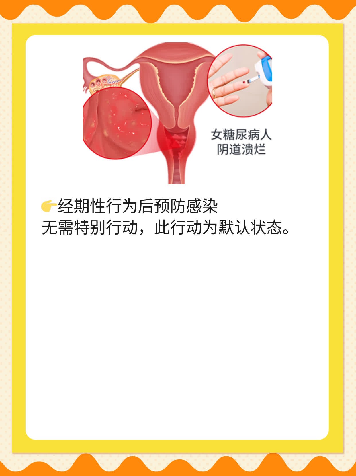经期性行为潜在风险及应对措施