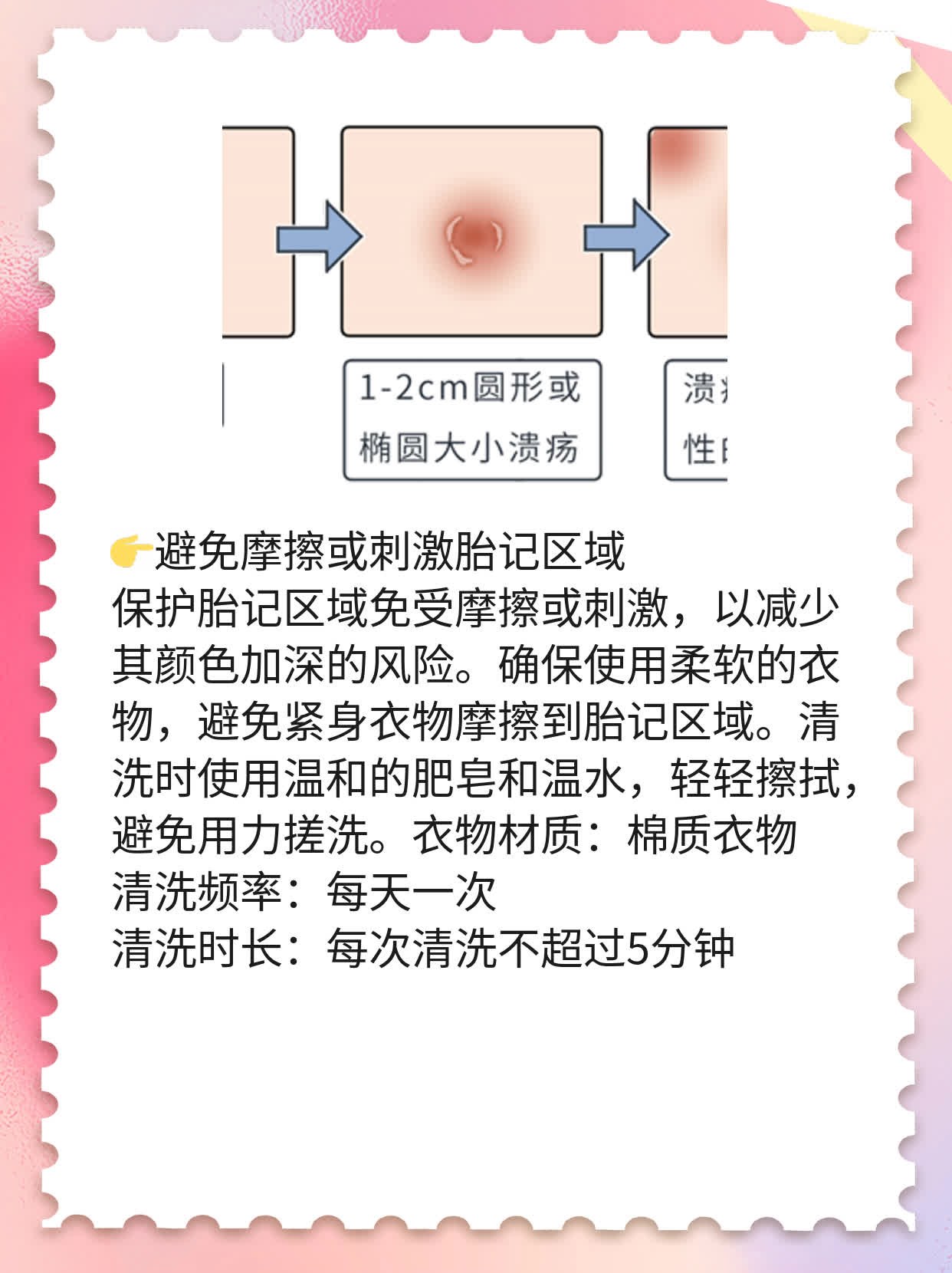 揭秘新生儿胎记成因：你不可不知的小秘密！