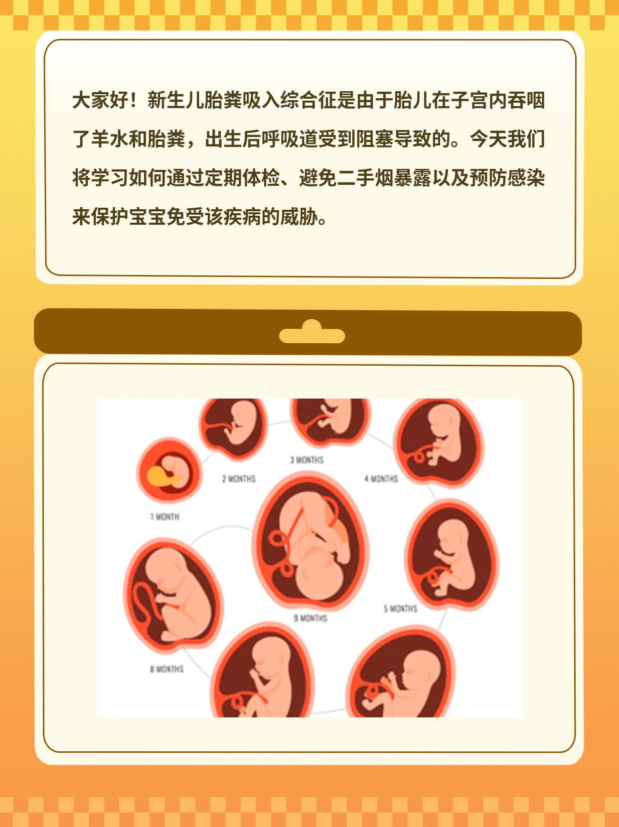 「新手爸妈必看」新生儿胎粪吸入综合征原因及护理