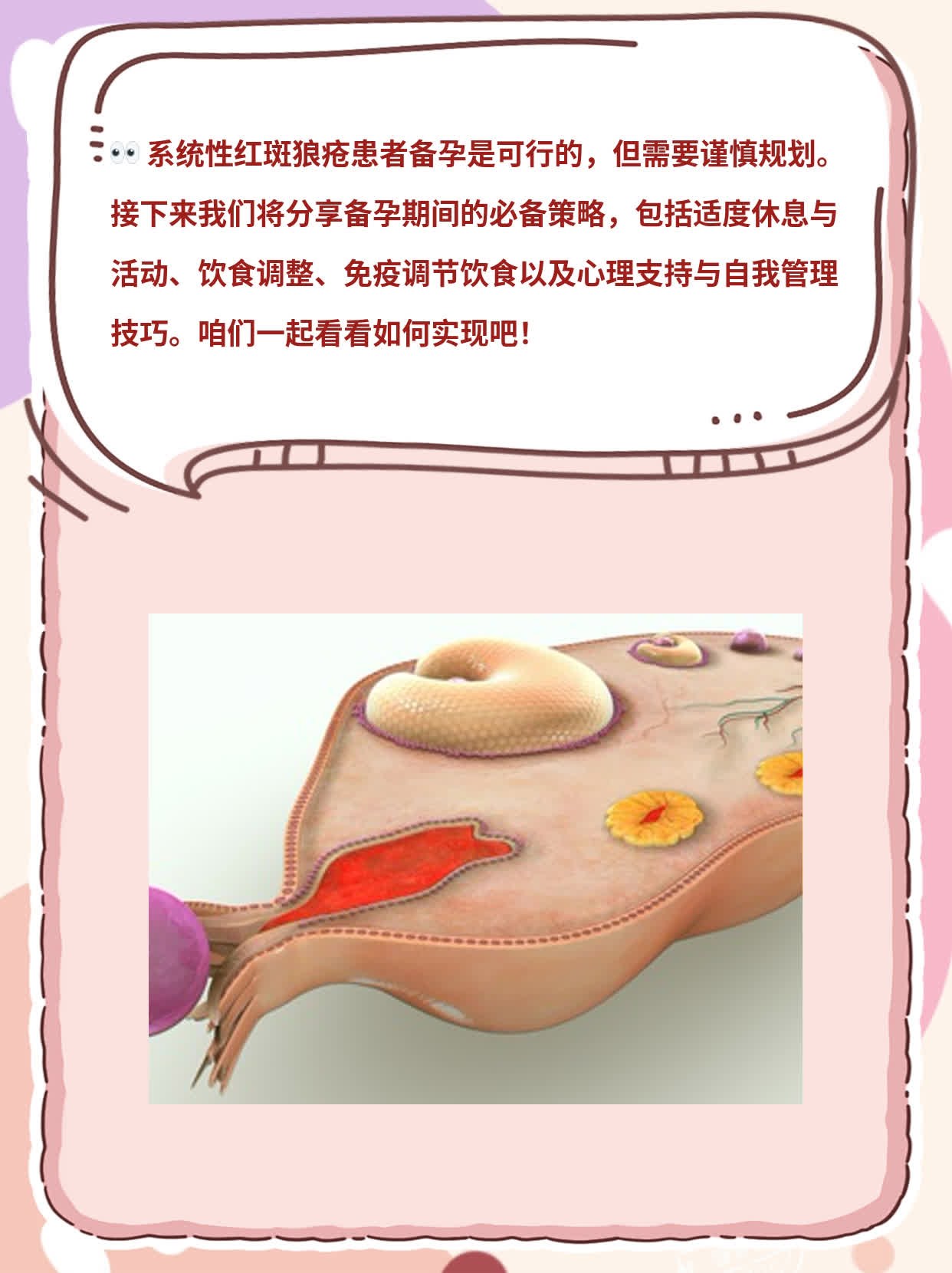 系统性红斑狼疮患者备孕可行吗？经验分享