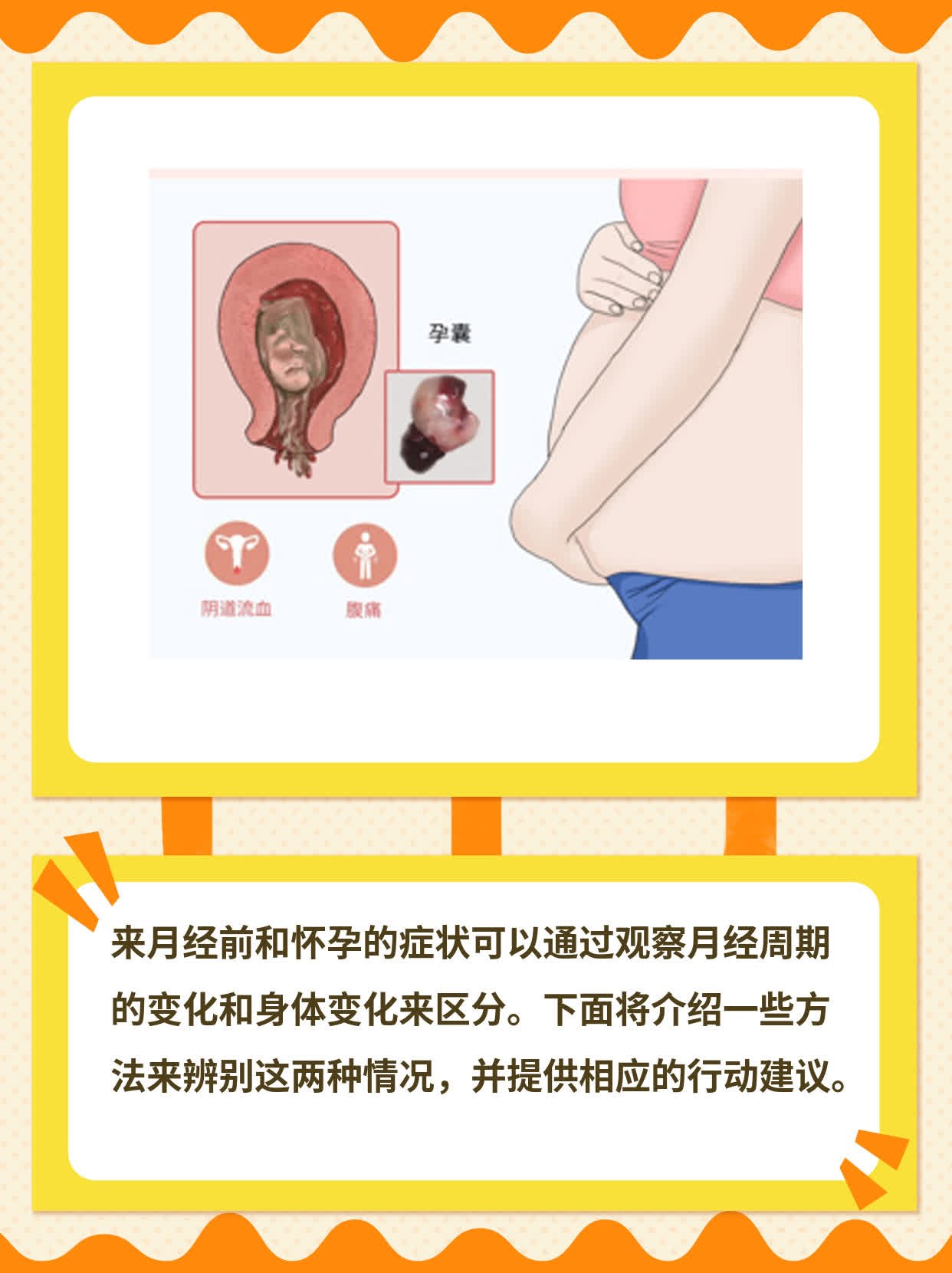 经期前VS孕期：如何辨别症状？