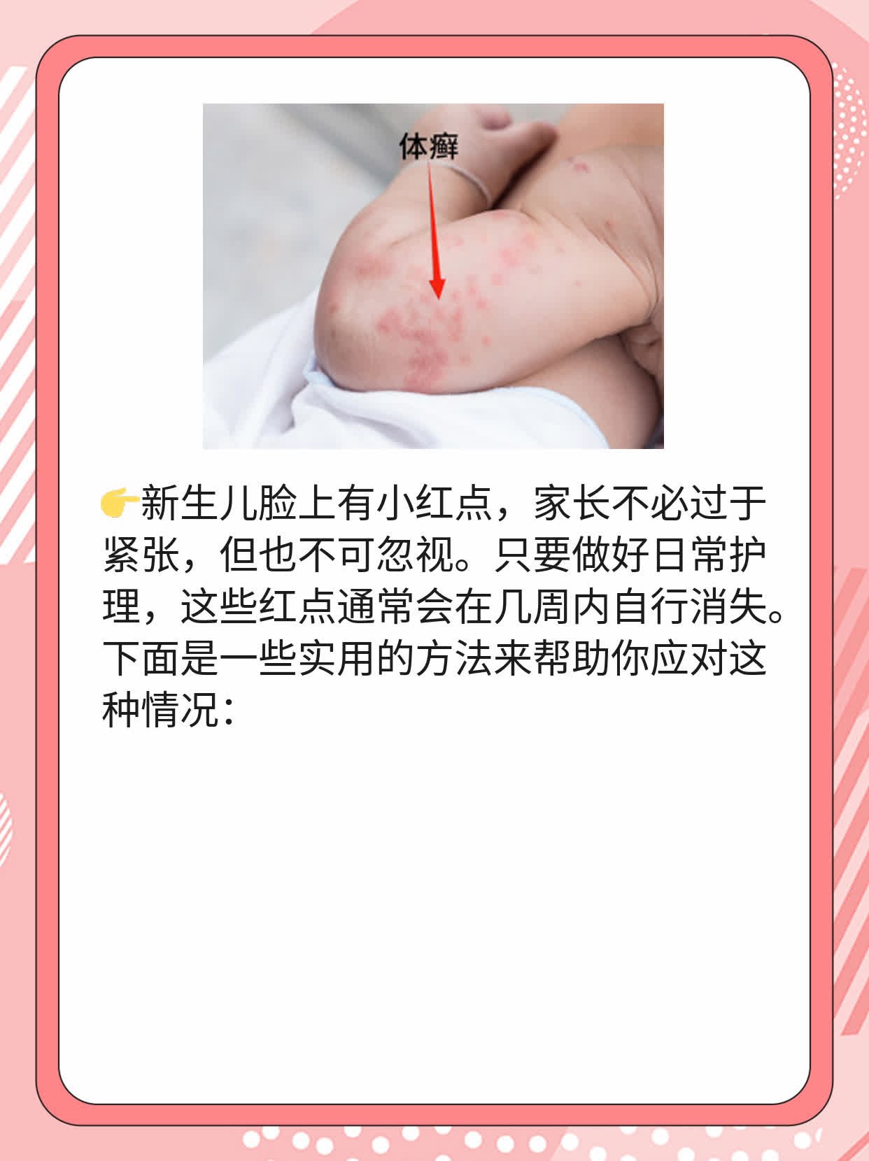 「新生儿红点」：如何处理宝宝脸上的小红点？