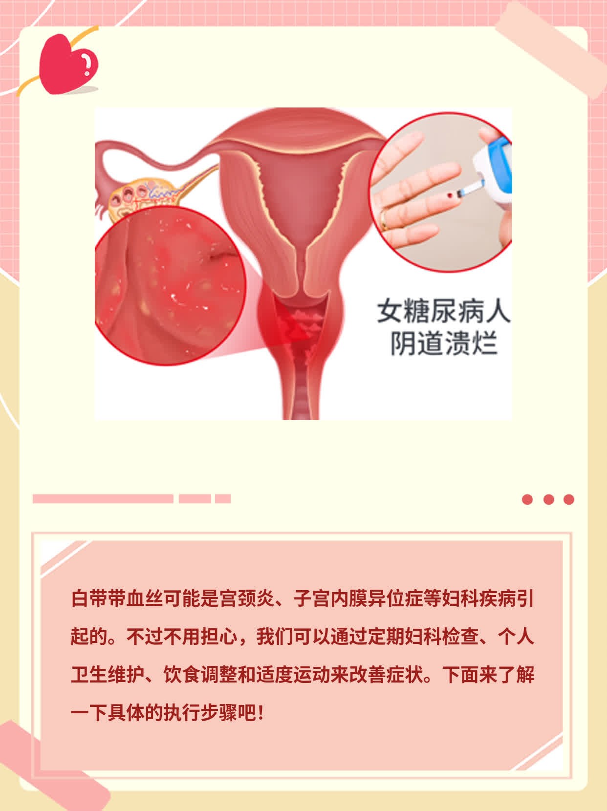 白带有血丝？揭秘原因！