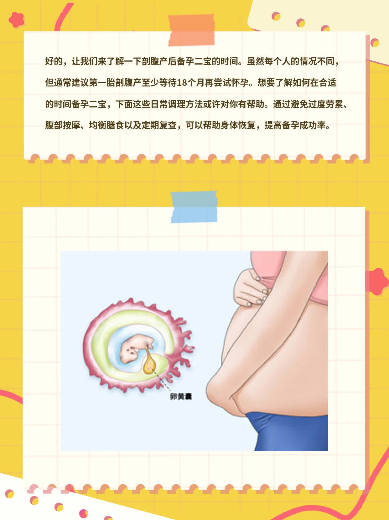剖腹产后多长时间能备孕二宝？