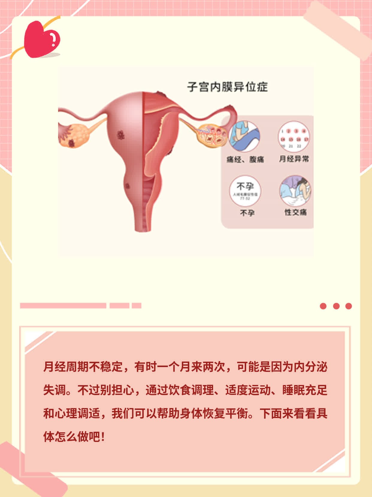 「月经乱了套」：探究女性经期紊乱的原因及应对方法