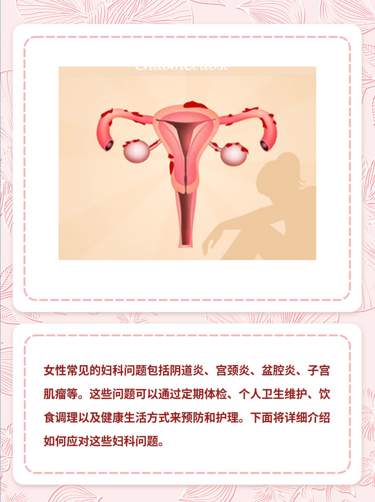 「女生私密话」：这些妇科问题你可能也遇到过！