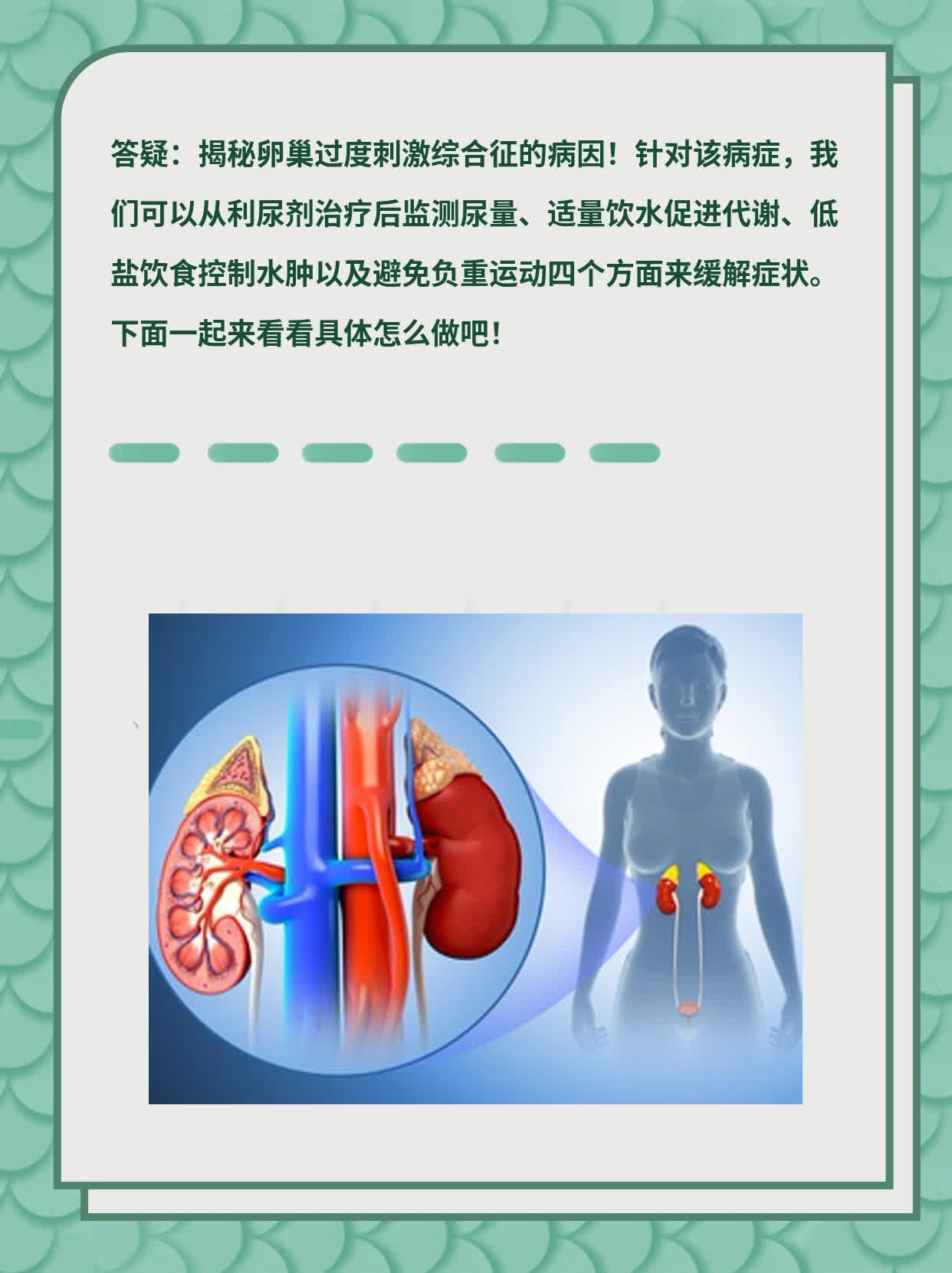 「答疑」：揭秘卵巢过度刺激综合征的病因！