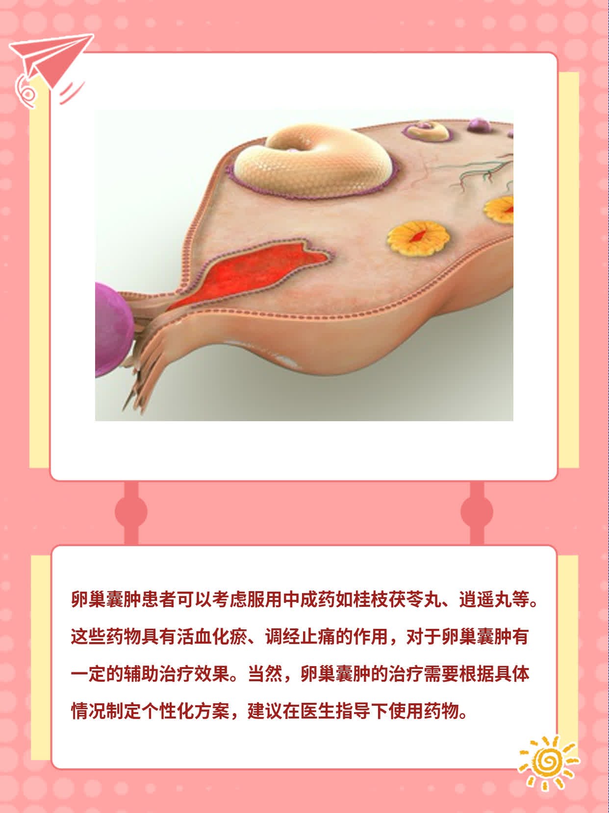 卵巢囊肿治疗：效果显著的药物推荐