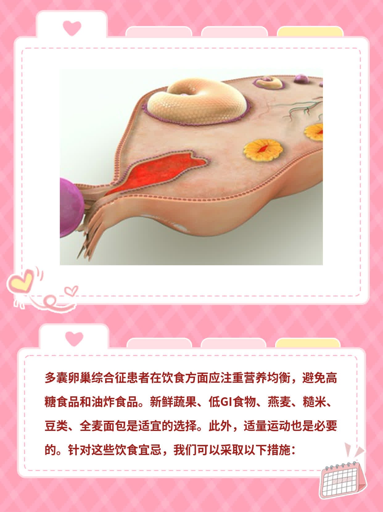 多囊卵巢综合征饮食宜忌