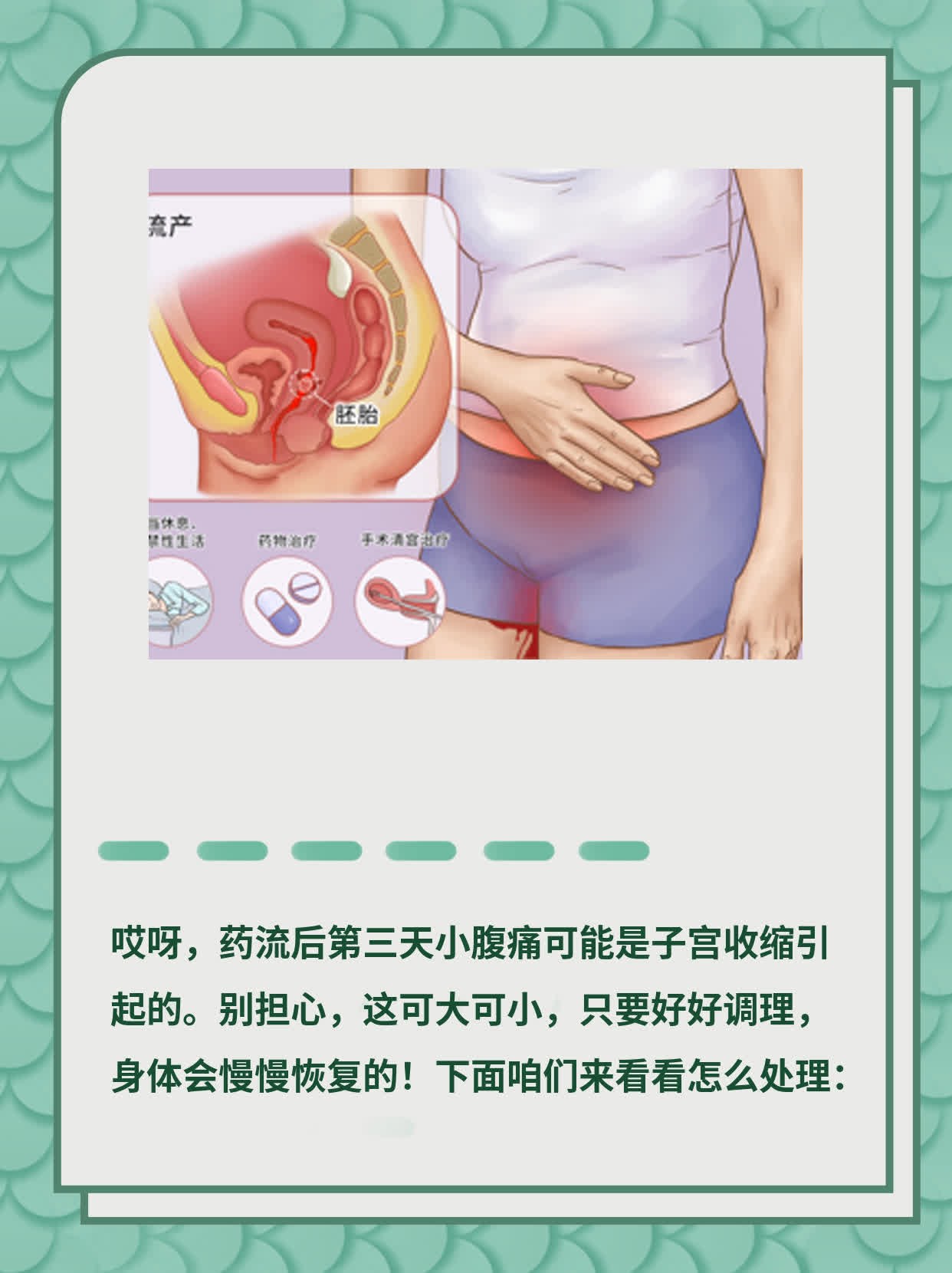 药流后第三天小腹痛是咋回事？经验分享！