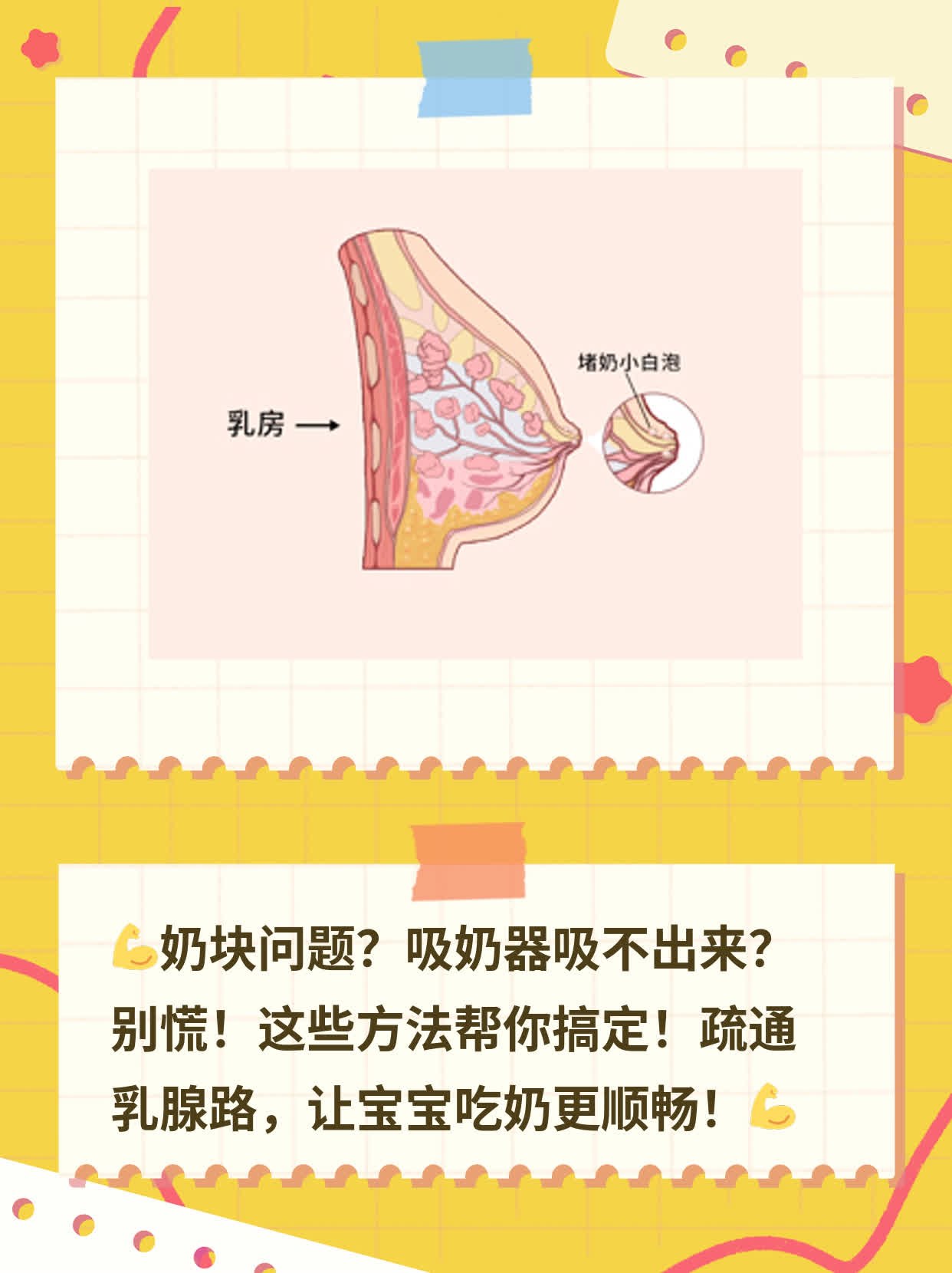 「有硬块」处理法：奶块+吸奶器=硬块消失！
