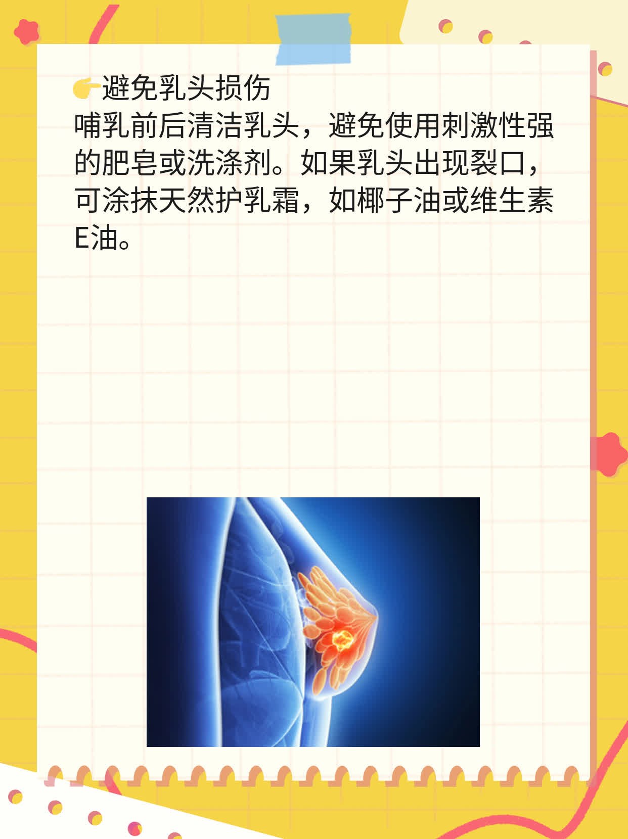 「有硬块」处理法：奶块+吸奶器=硬块消失！