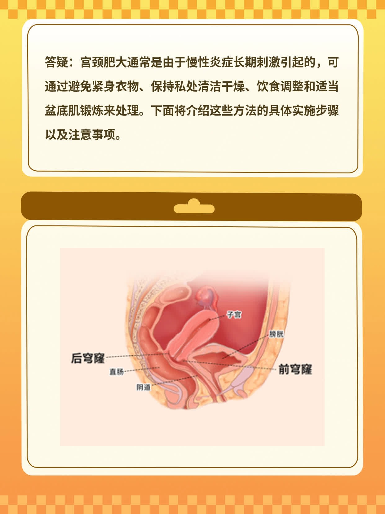 「答疑」宫颈肥大的原因及处理方法