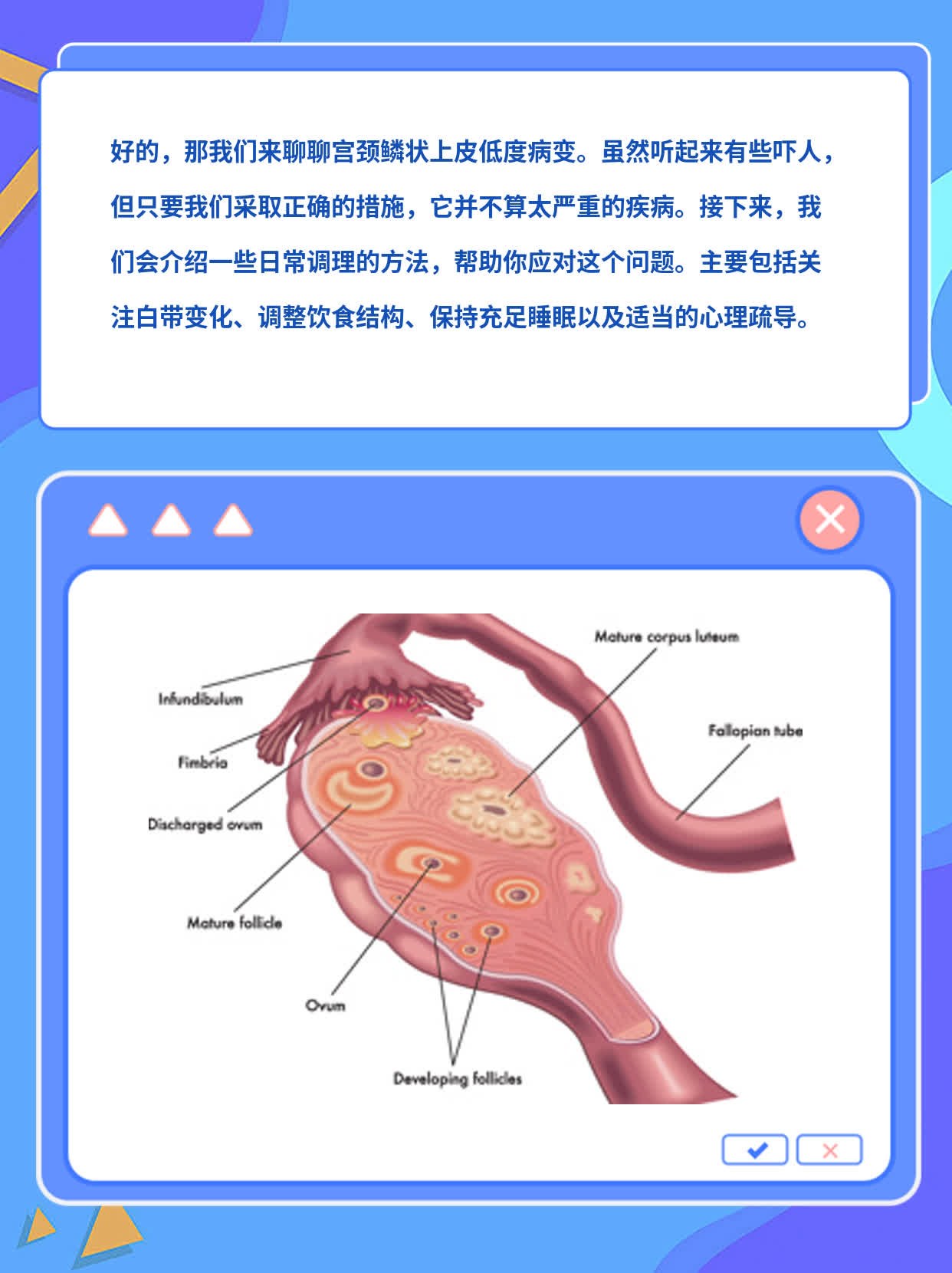 宫颈鳞状上皮低度病变——别慌！这事儿有解！
