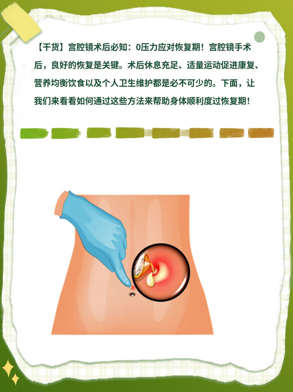 【干货】宫腔镜术后必知：0压力应对恢复期！