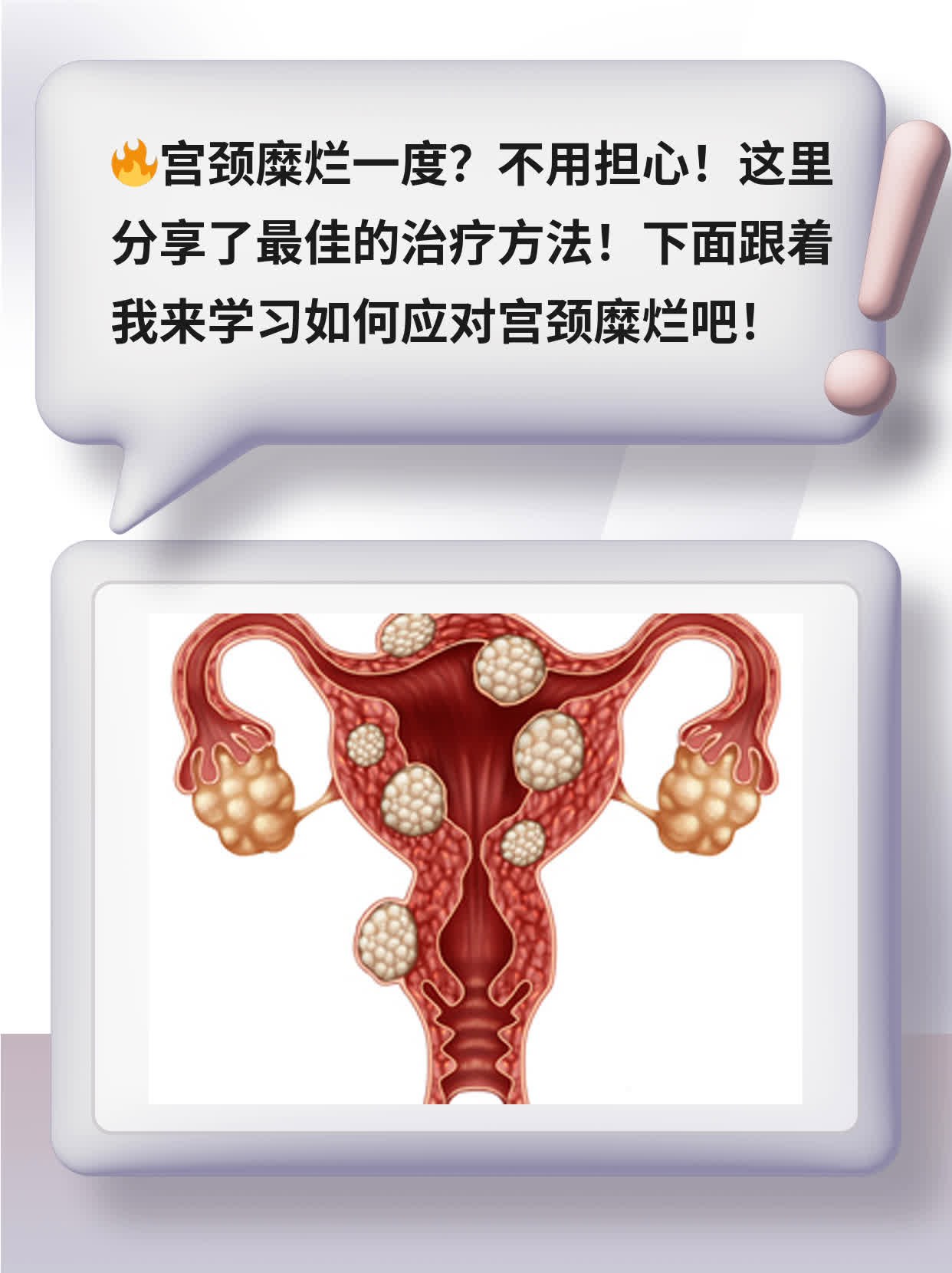 宫颈糜烂度：最佳治疗方法分享！