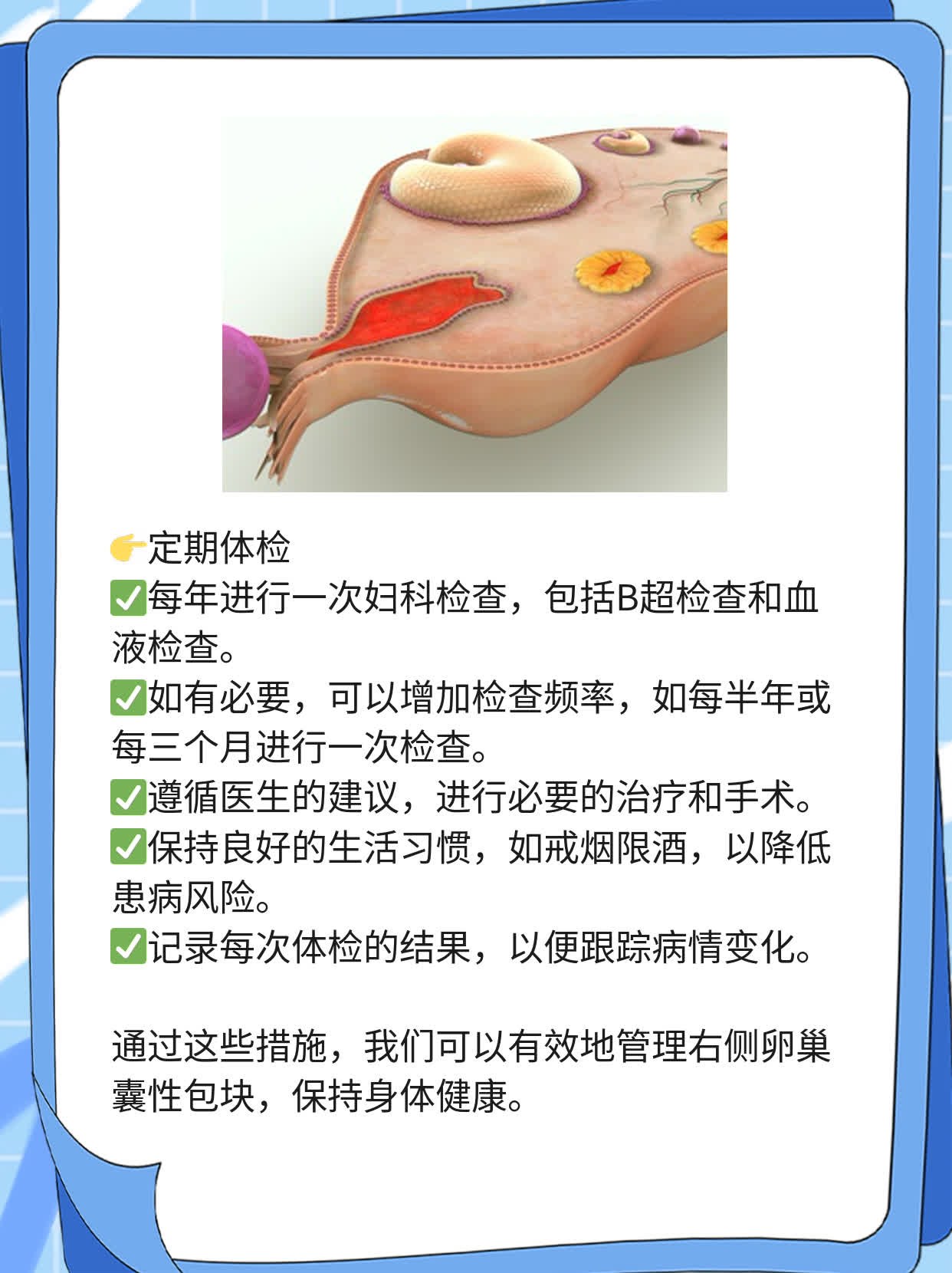 「右侧卵巢囊性包块」是怎么回事？