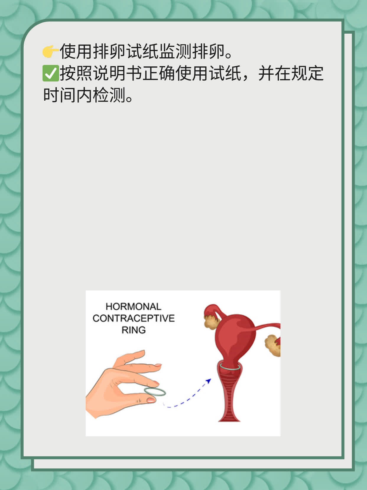 不孕症检查全攻略：女性必知！