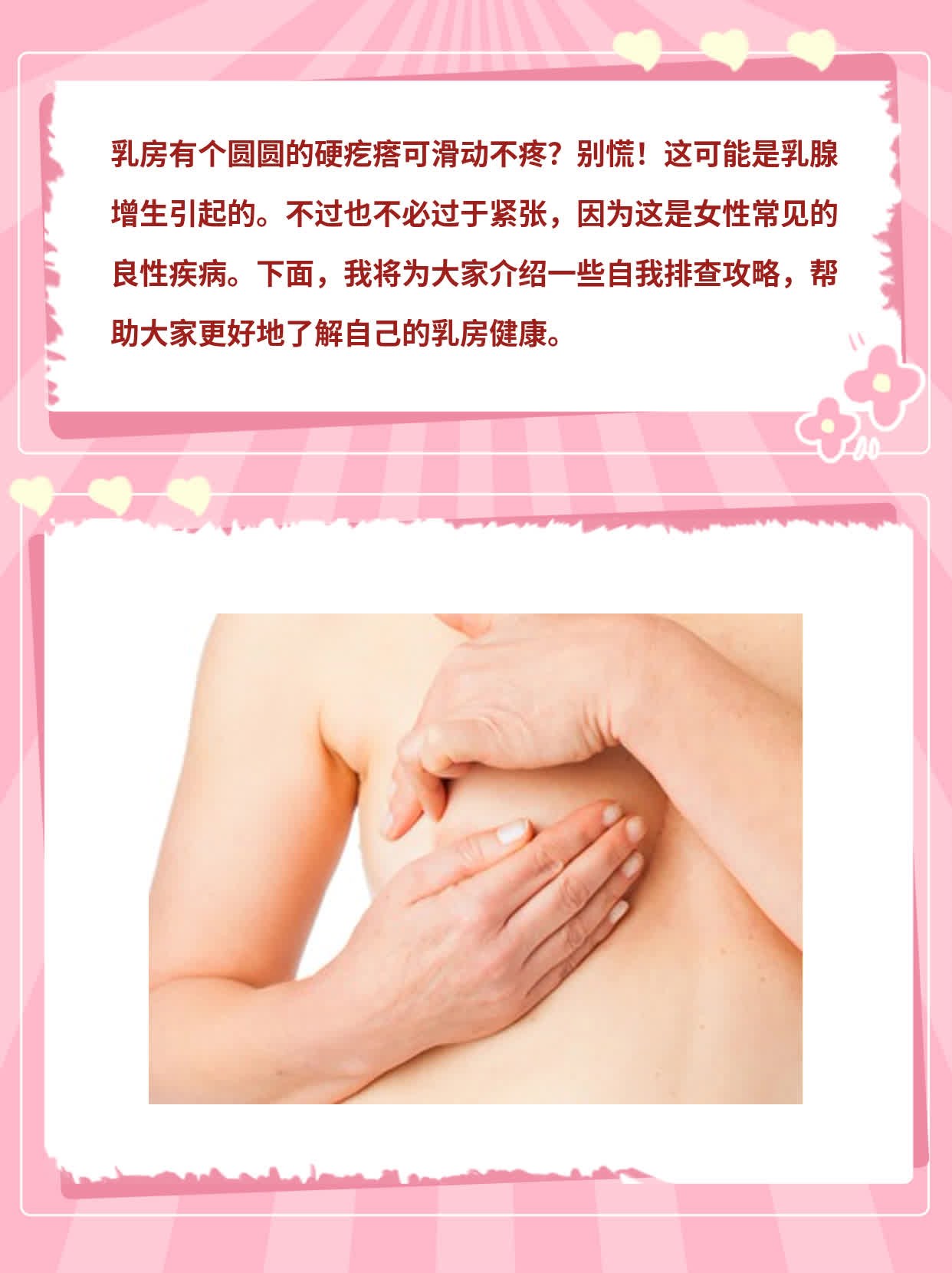 乳房滑动无痛肿块”下的自我排查攻略