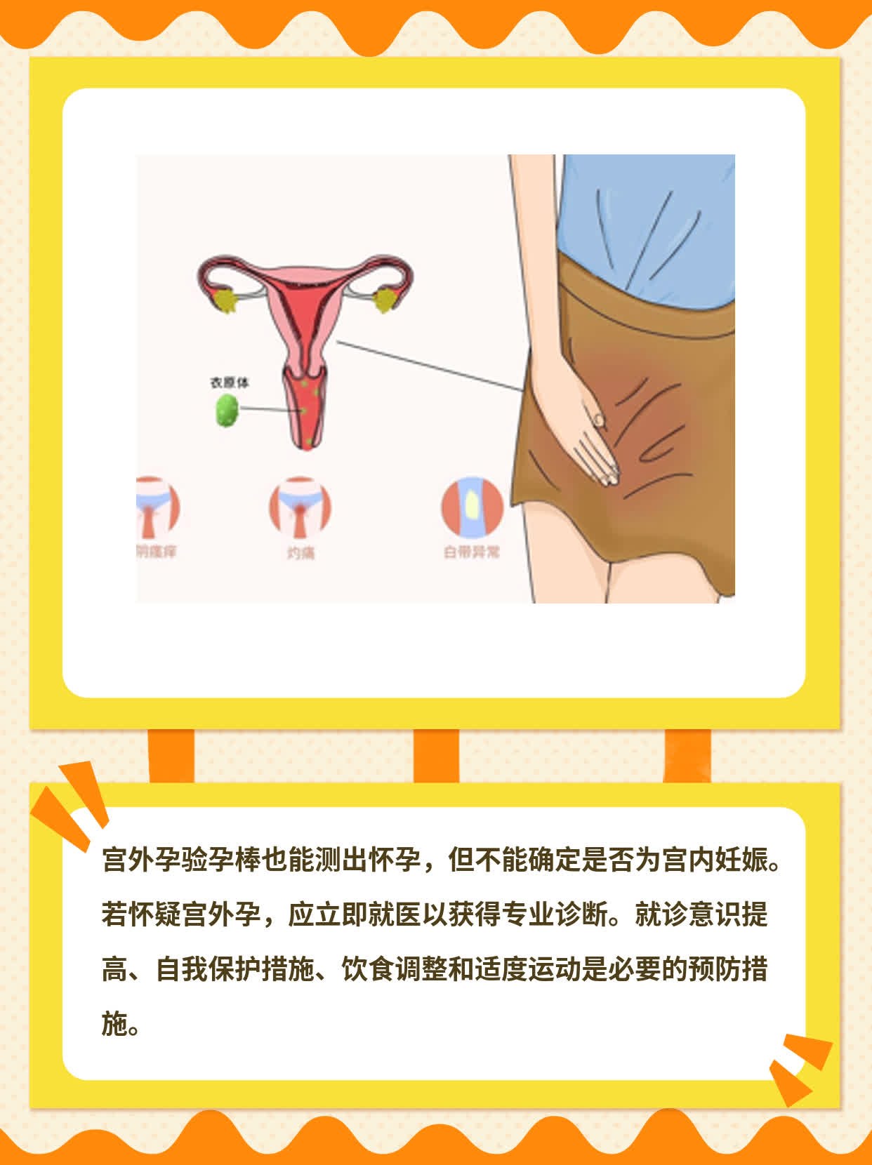 宫外孕验孕棒能测出怀孕吗？