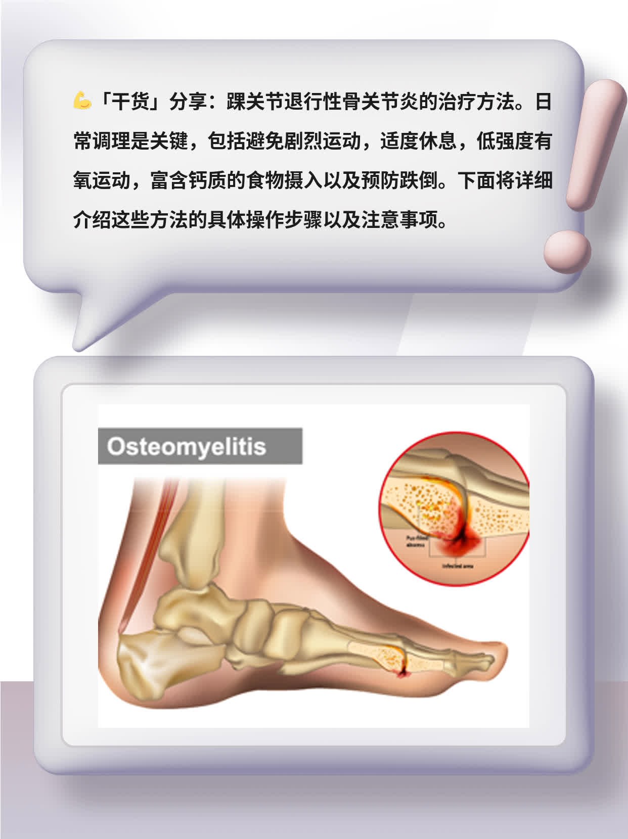 「干货」踝关节退行性骨关节炎的治疗方法分享
