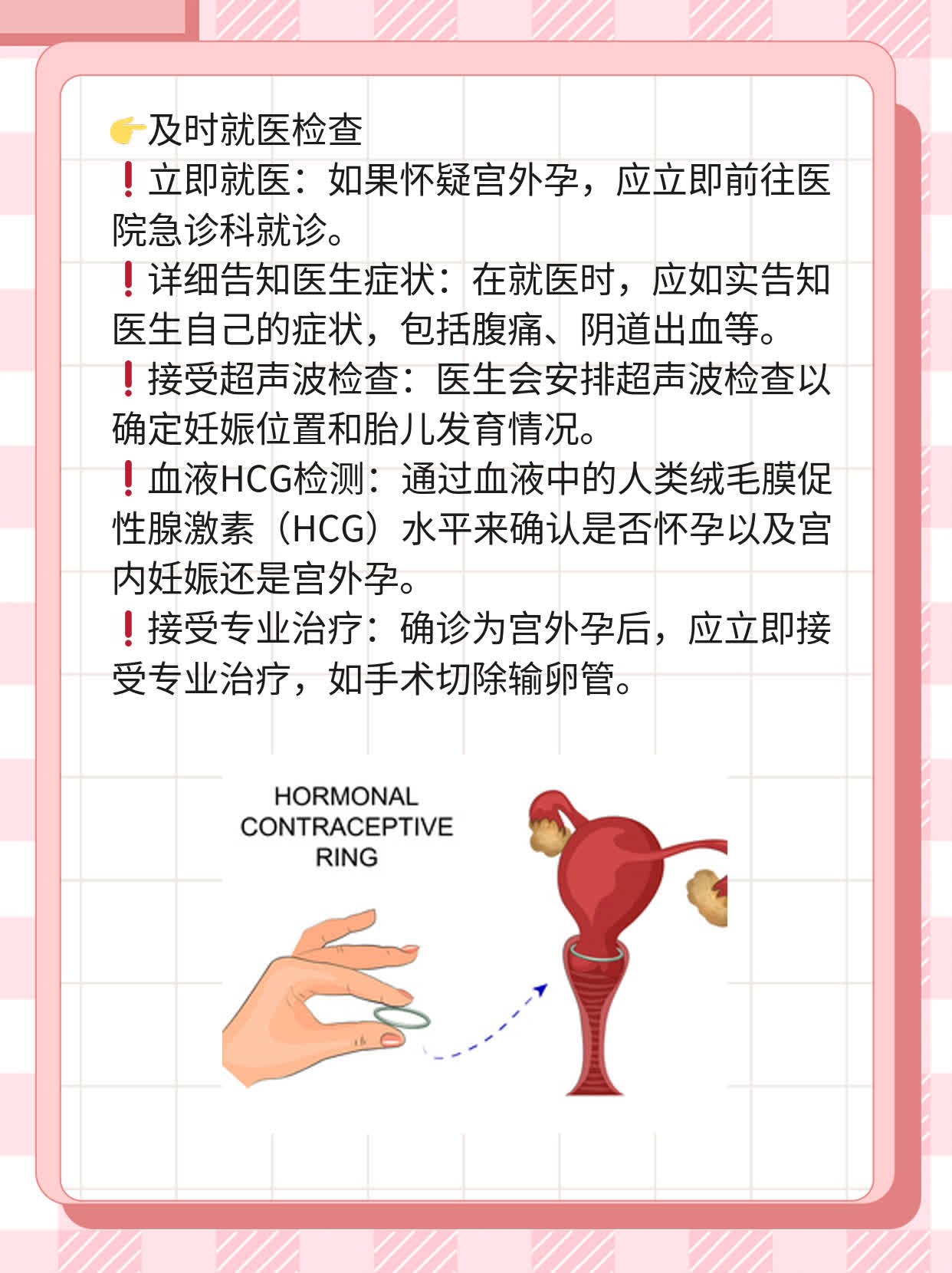 「宫外孕」症状出现时间，你必须知道！
