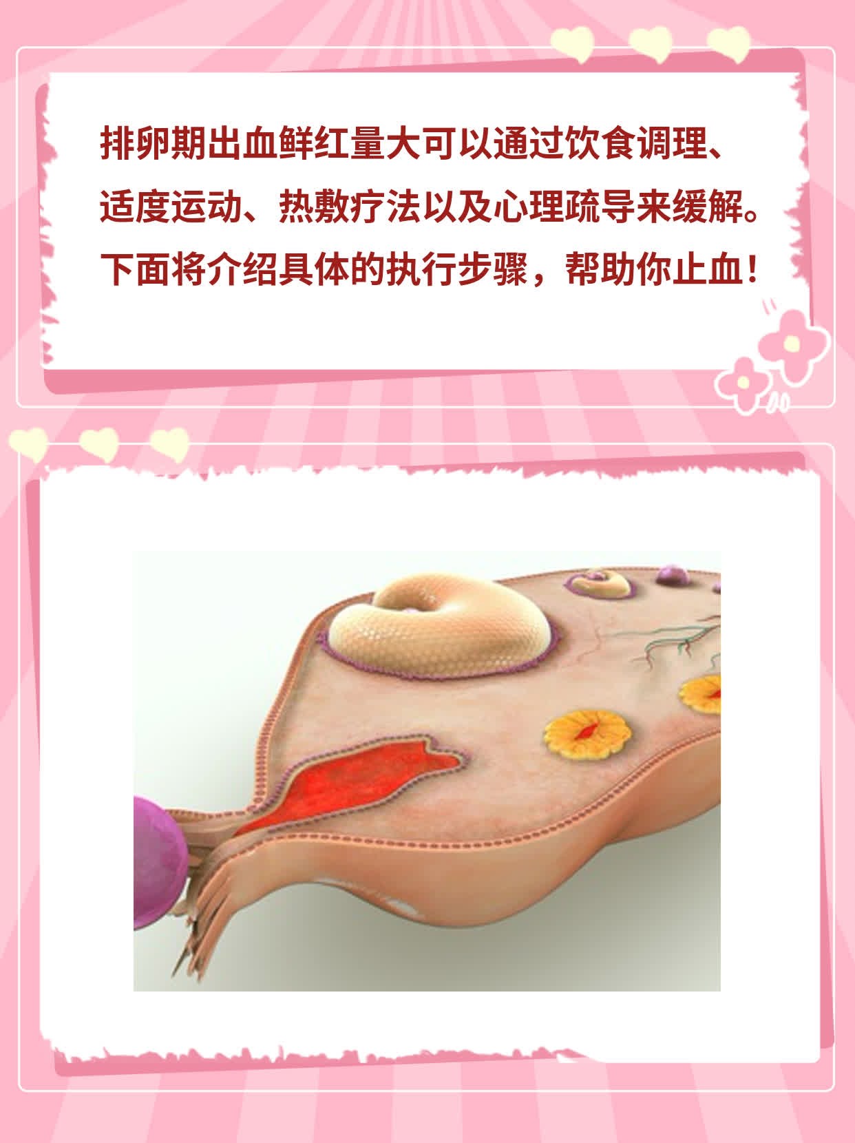 排卵期出血多、鲜红色？这些方法帮你止血！