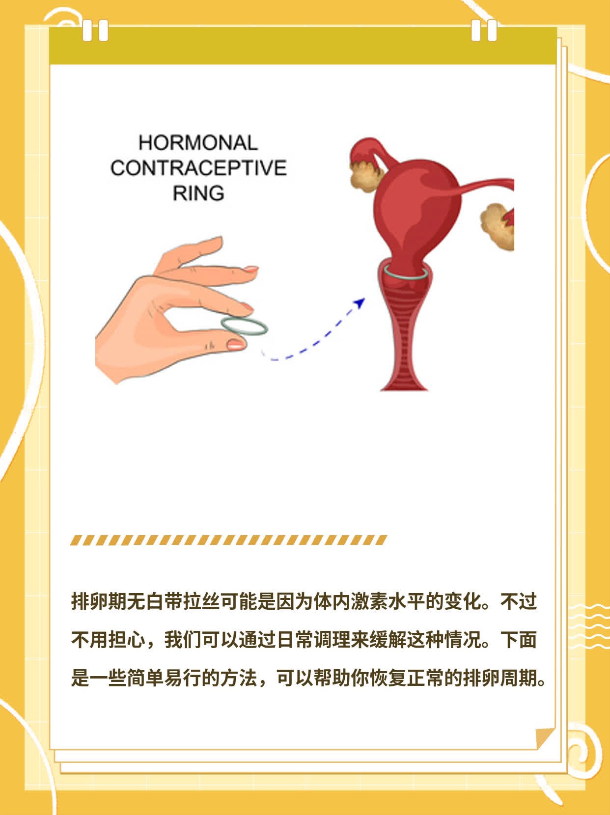 排卵期无白带拉丝？
