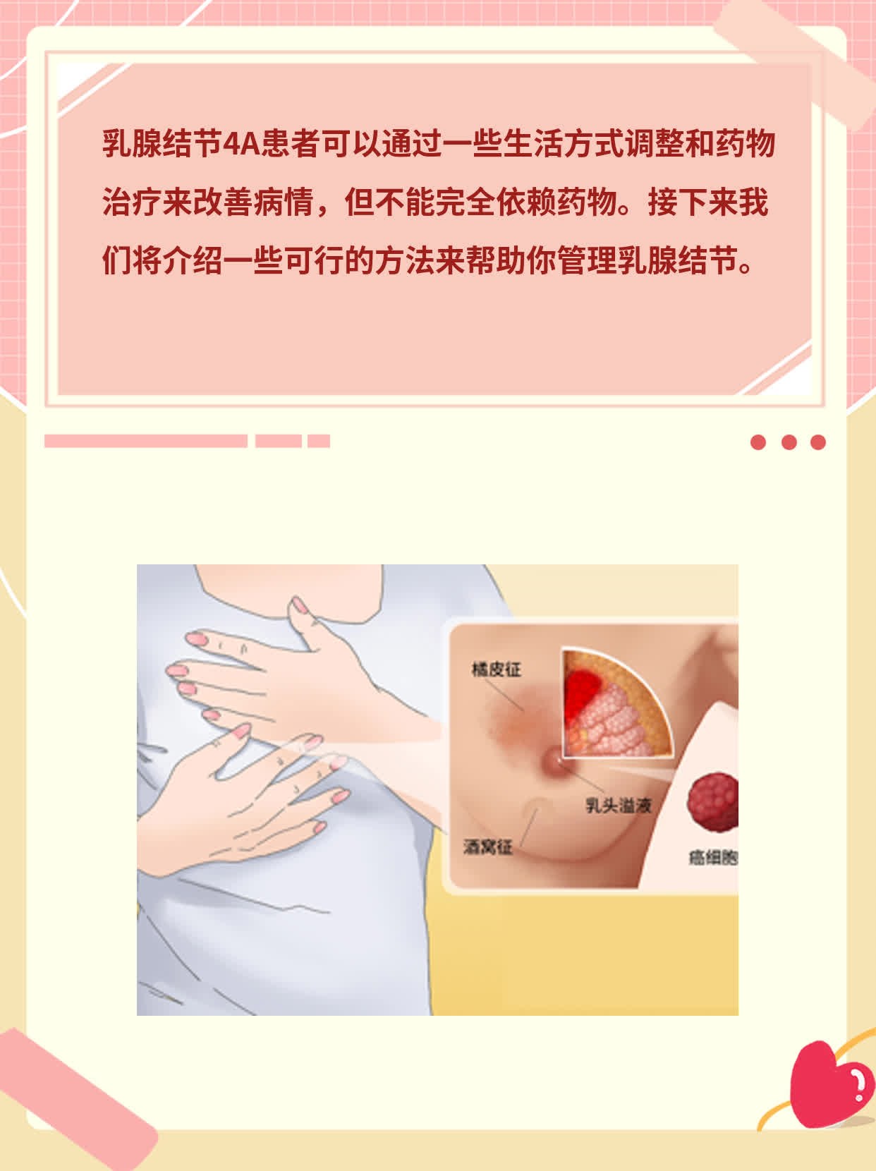 乳腺结节4A能调养恢复吗？