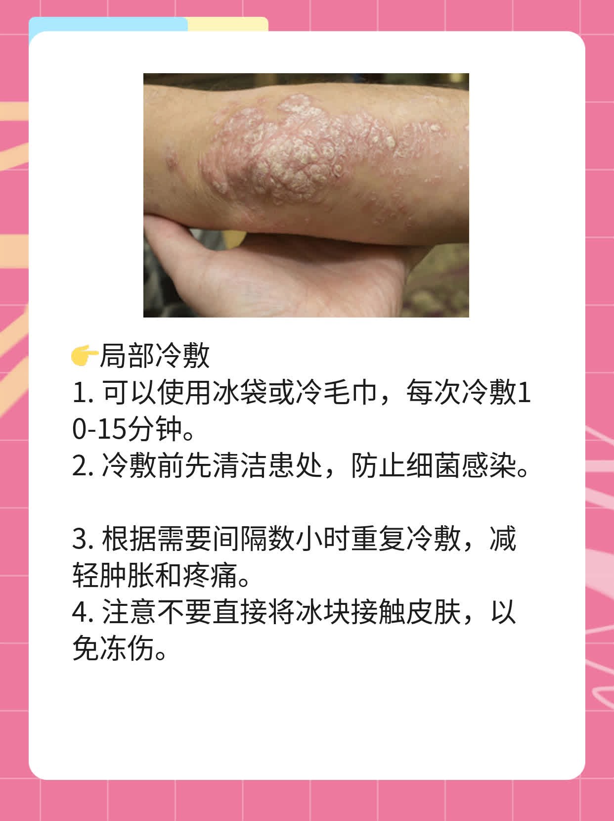 附睾炎的治疗妙招大全！